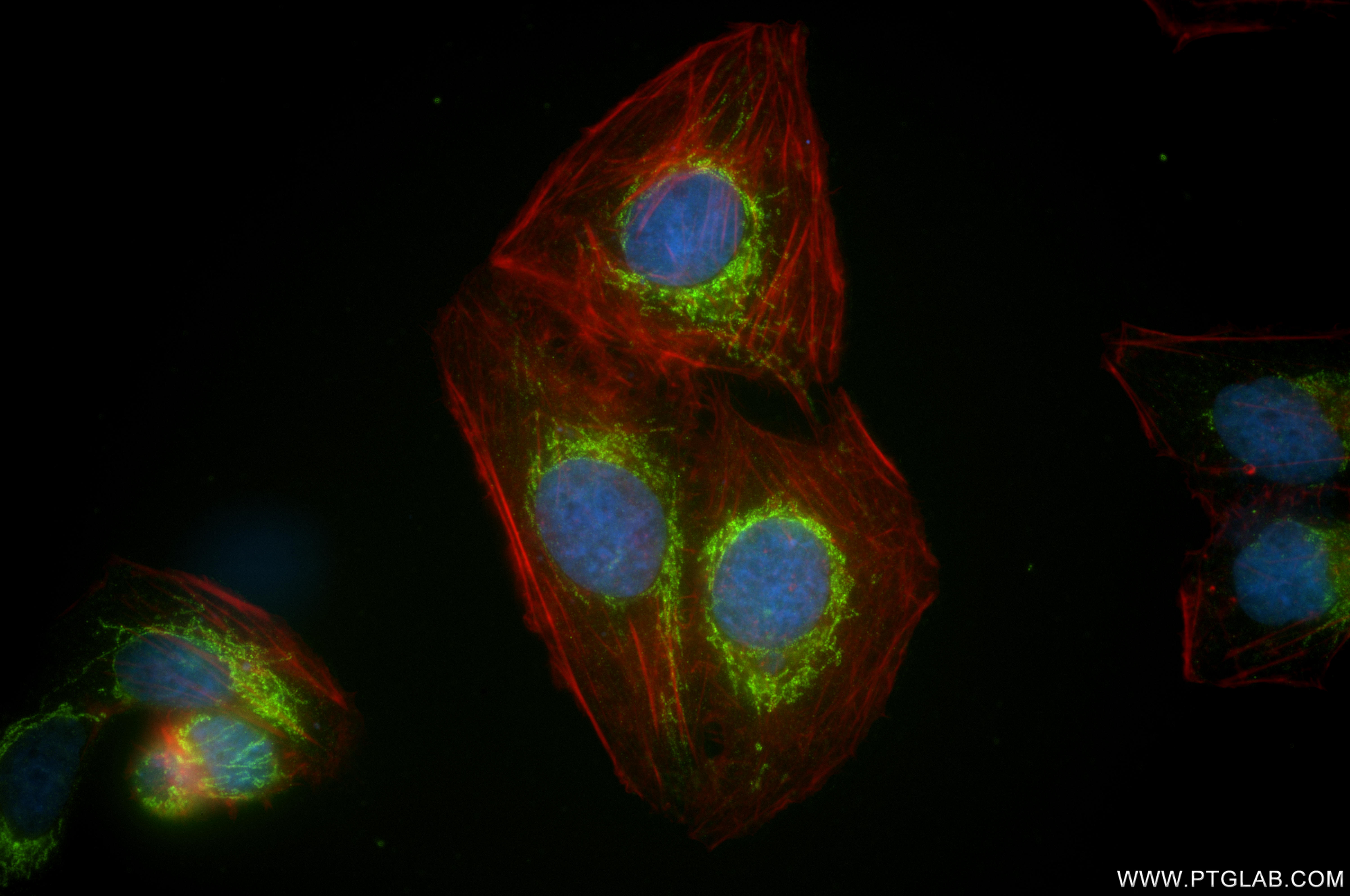 IF Staining of U2OS using 86549-1-RR (same clone as 86549-1-PBS)