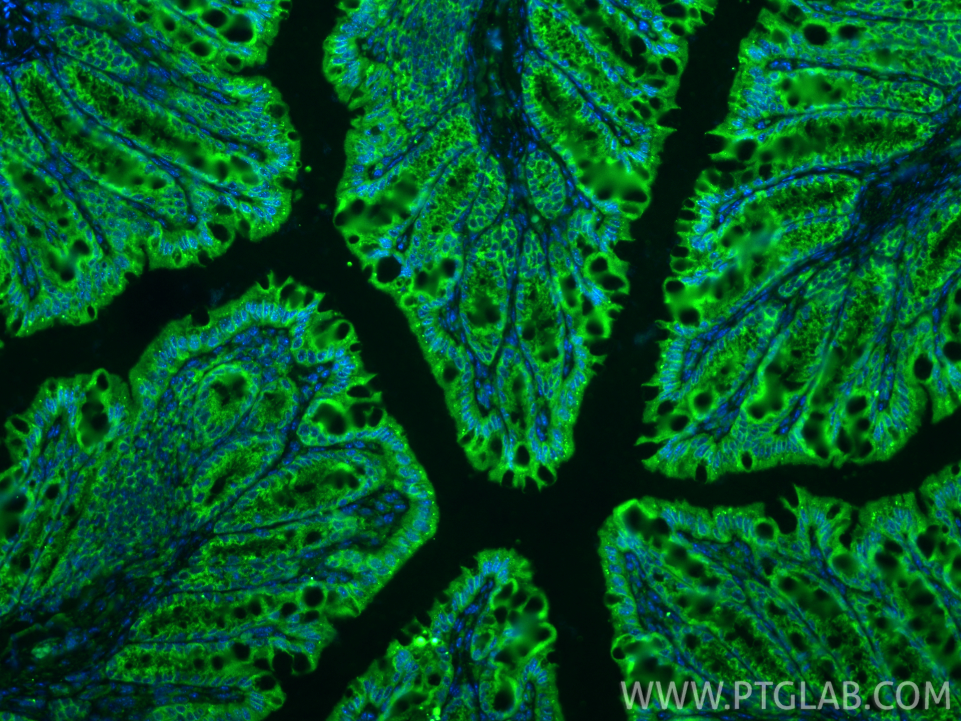 IF Staining of mouse colon using 28674-1-AP