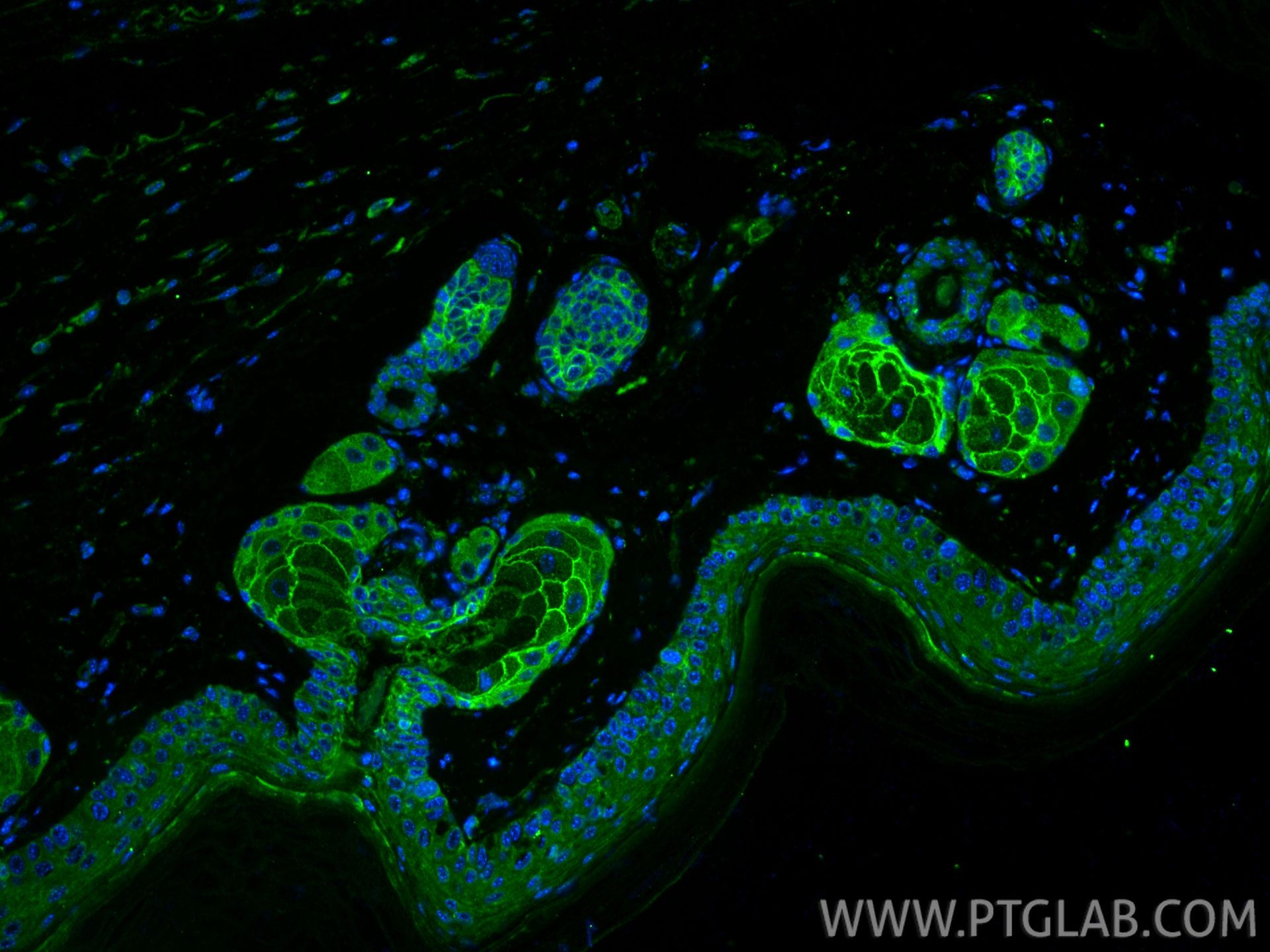 IF Staining of mouse skin using 28674-1-AP
