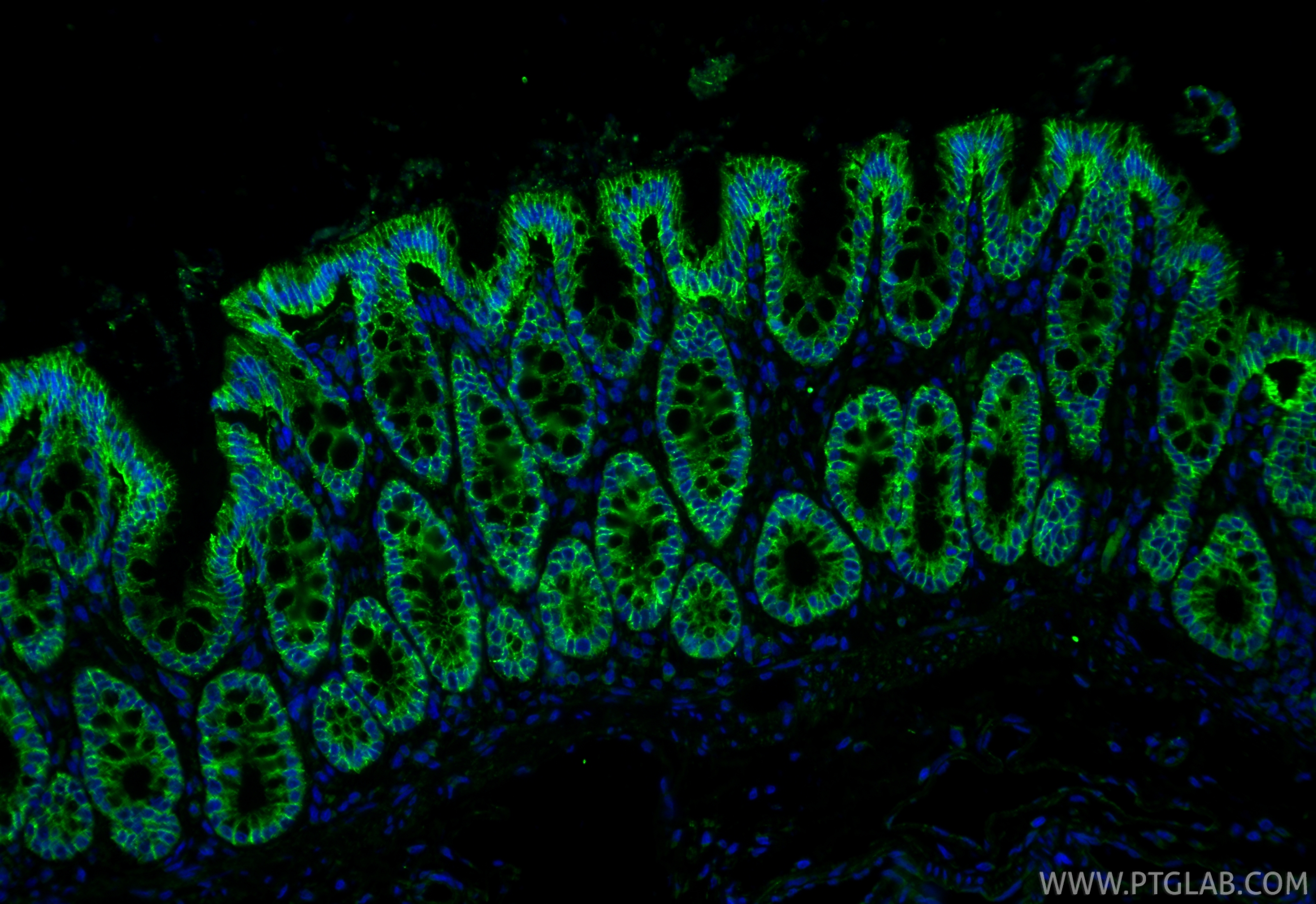 IF Staining of rat colon using 28674-1-AP IF Staining of rat colon using 28674-1-AP