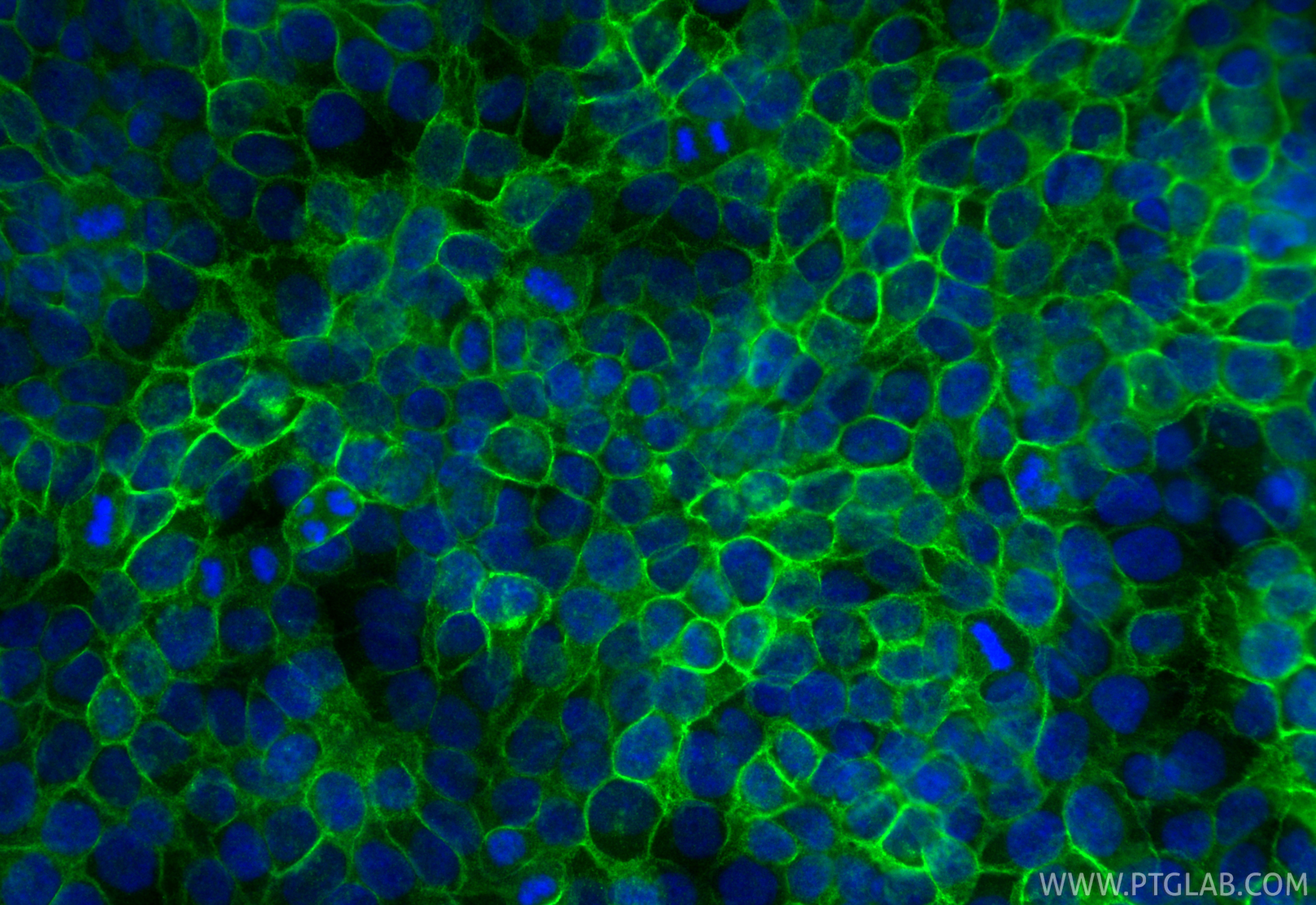 IF Staining of HaCaT using 28674-1-AP IF Staining of HaCaT using 28674-1-AP