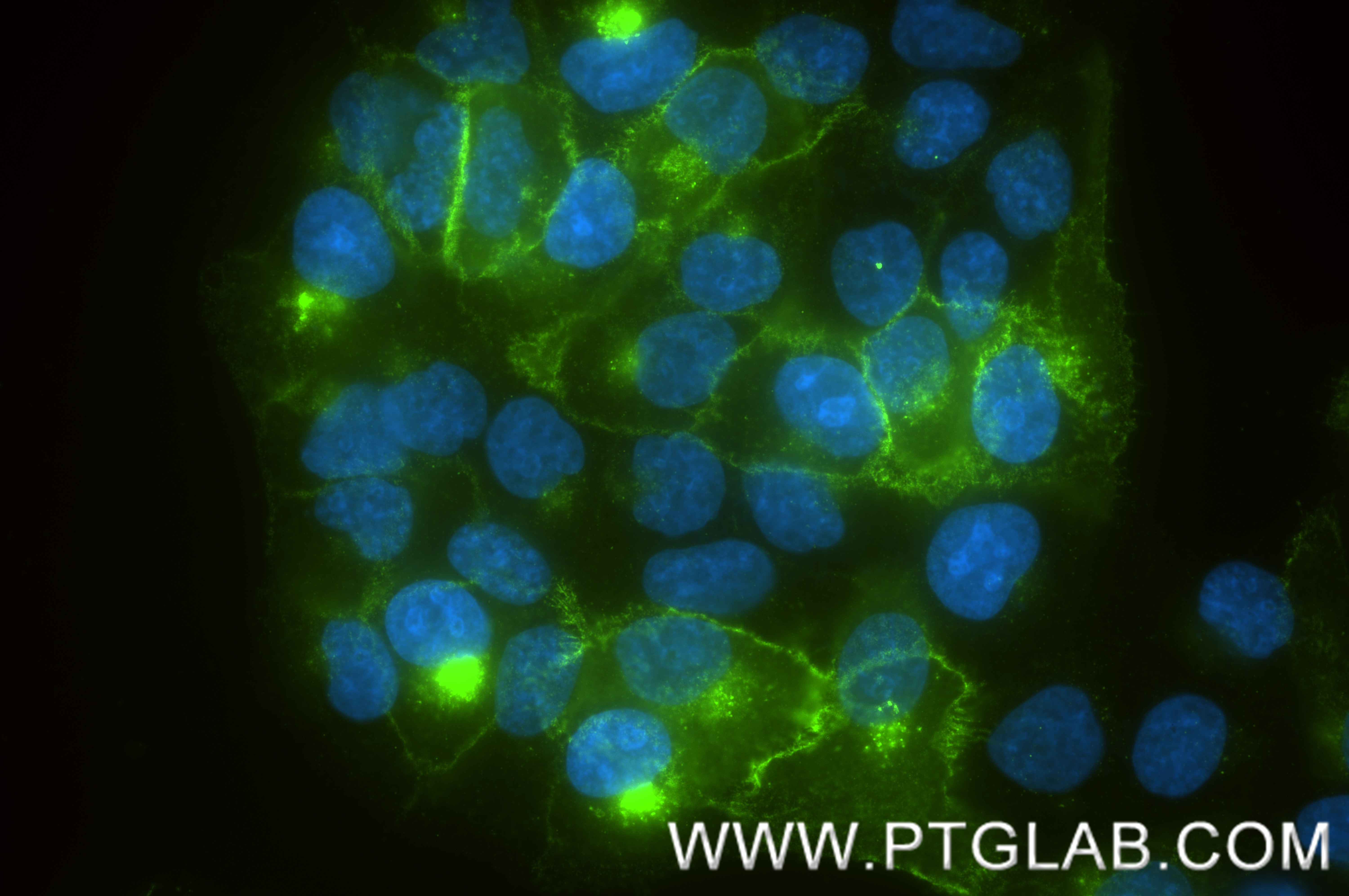 IF Staining of HaCaT using 87782-2-RR (same clone as 87782-2-PBS)