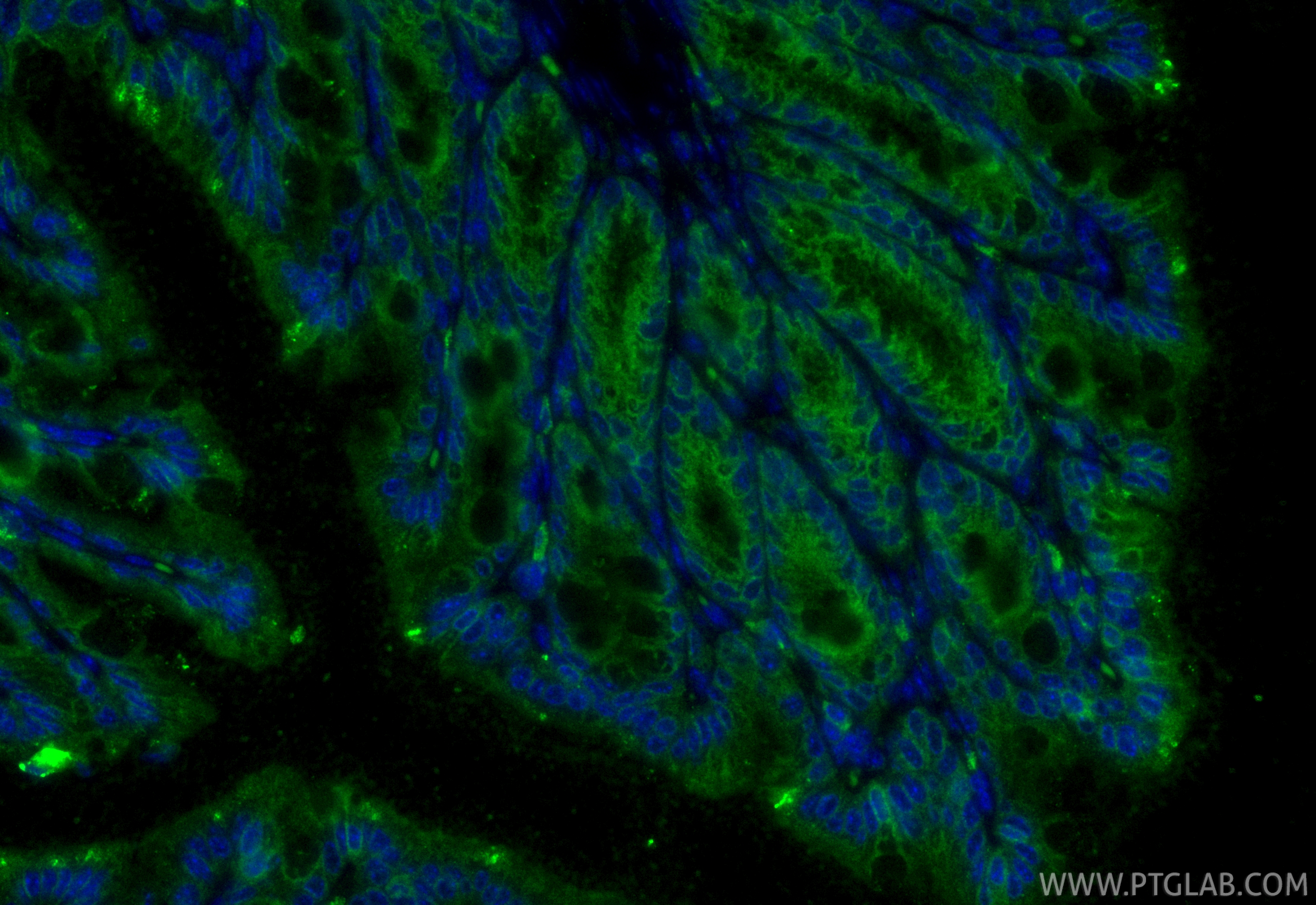 IF Staining of mouse colon using 87782-2-RR (same clone as 87782-2-PBS)