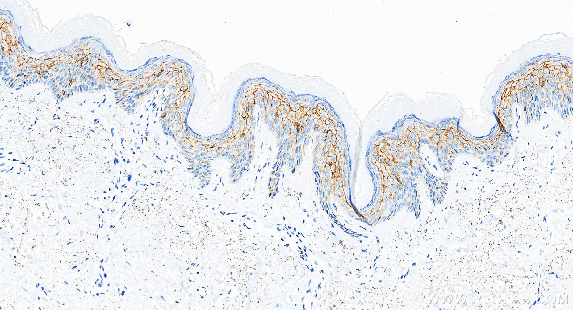 IHC staining of human skin using 87782-2-RR (same clone as 87782-2-PBS)