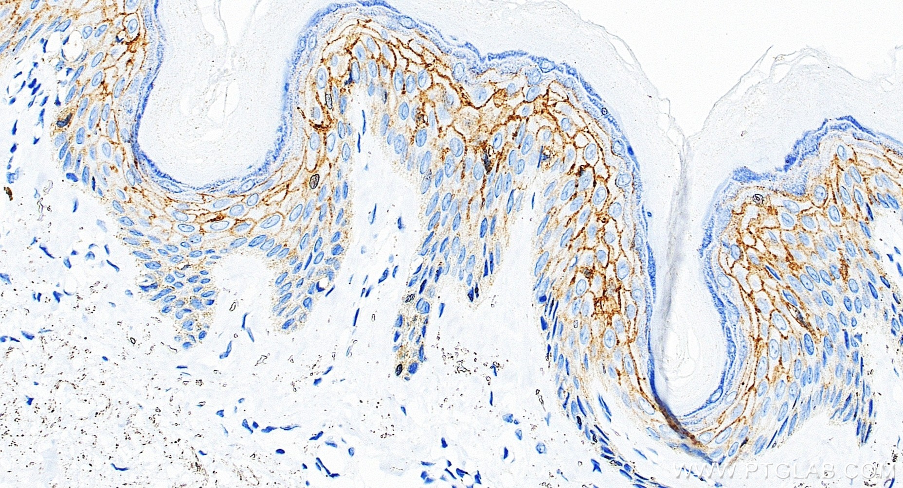 IHC staining of human skin using 87782-2-RR (same clone as 87782-2-PBS)