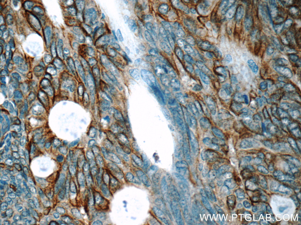 Claudin 23 Polyclonal antibody