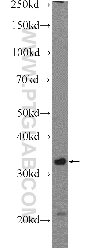 Claudin 23 Polyclonal antibody