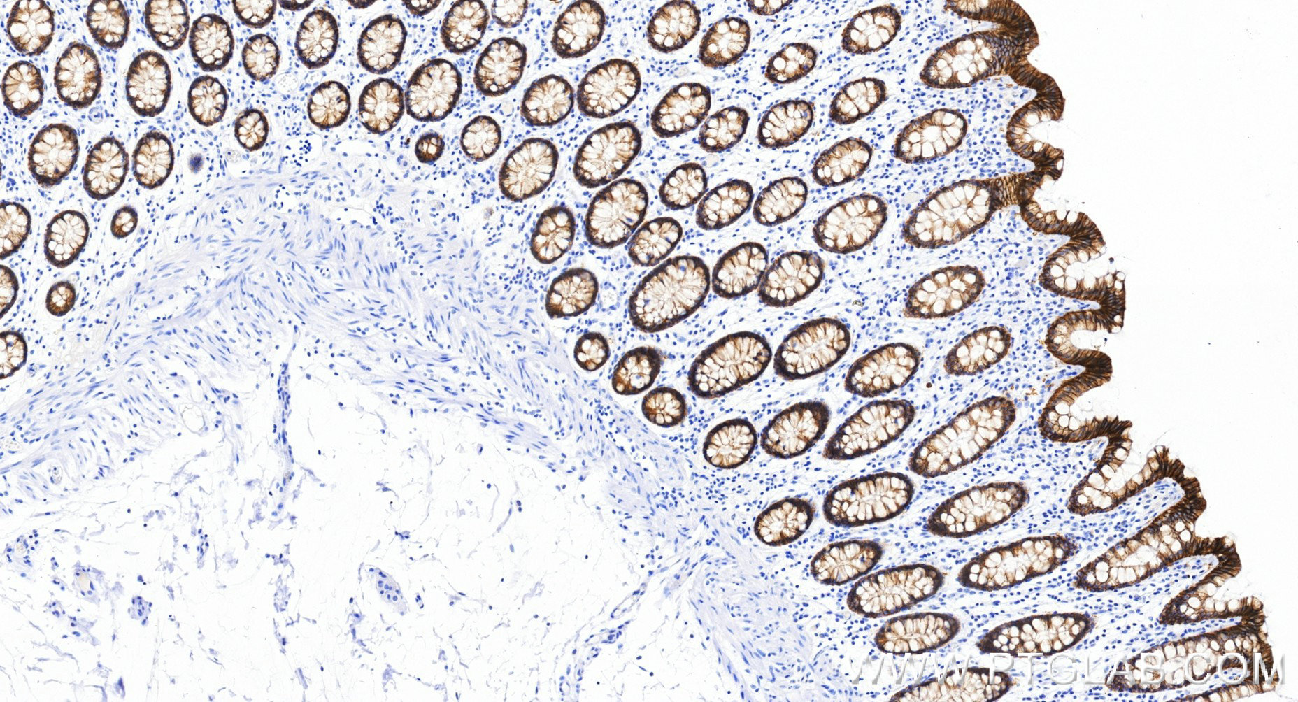 IHC staining of human colon using 86433-8-RR (same clone as 86433-8-PBS) IHC staining of human colon using 86433-8-RR (same clone as 86433-8-PBS)