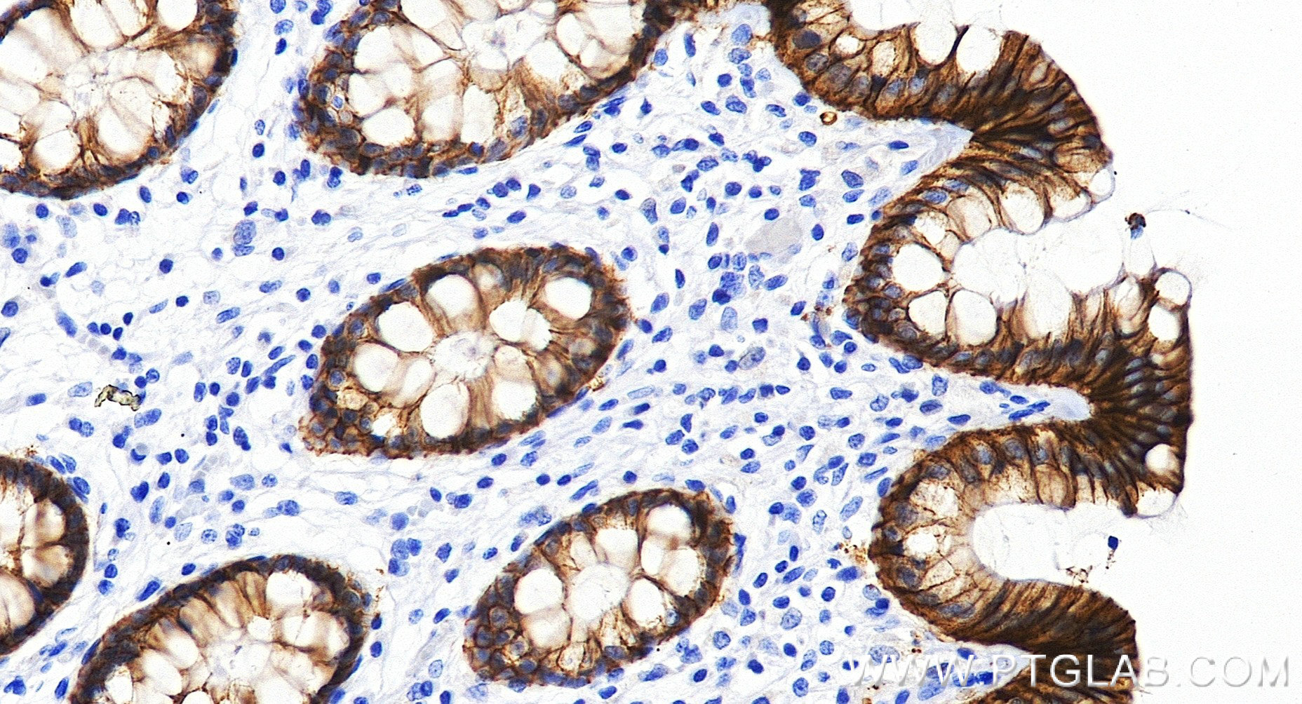 IHC staining of human colon using 86433-8-RR (same clone as 86433-8-PBS) IHC staining of human colon using 86433-8-RR (same clone as 86433-8-PBS)