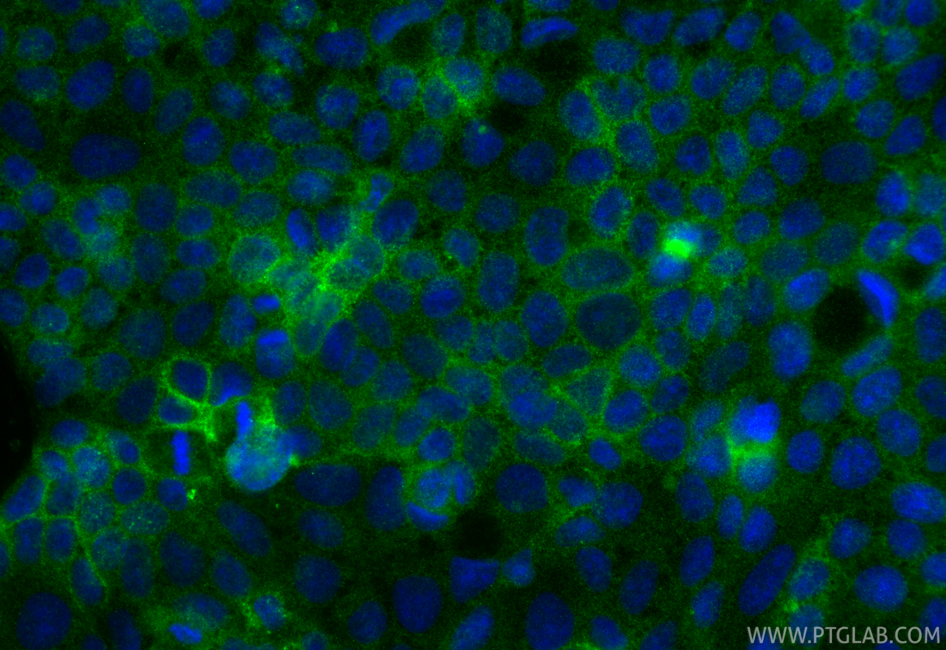 IF Staining of Caco-2 using 86433-8-RR (same clone as 86433-8-PBS)
