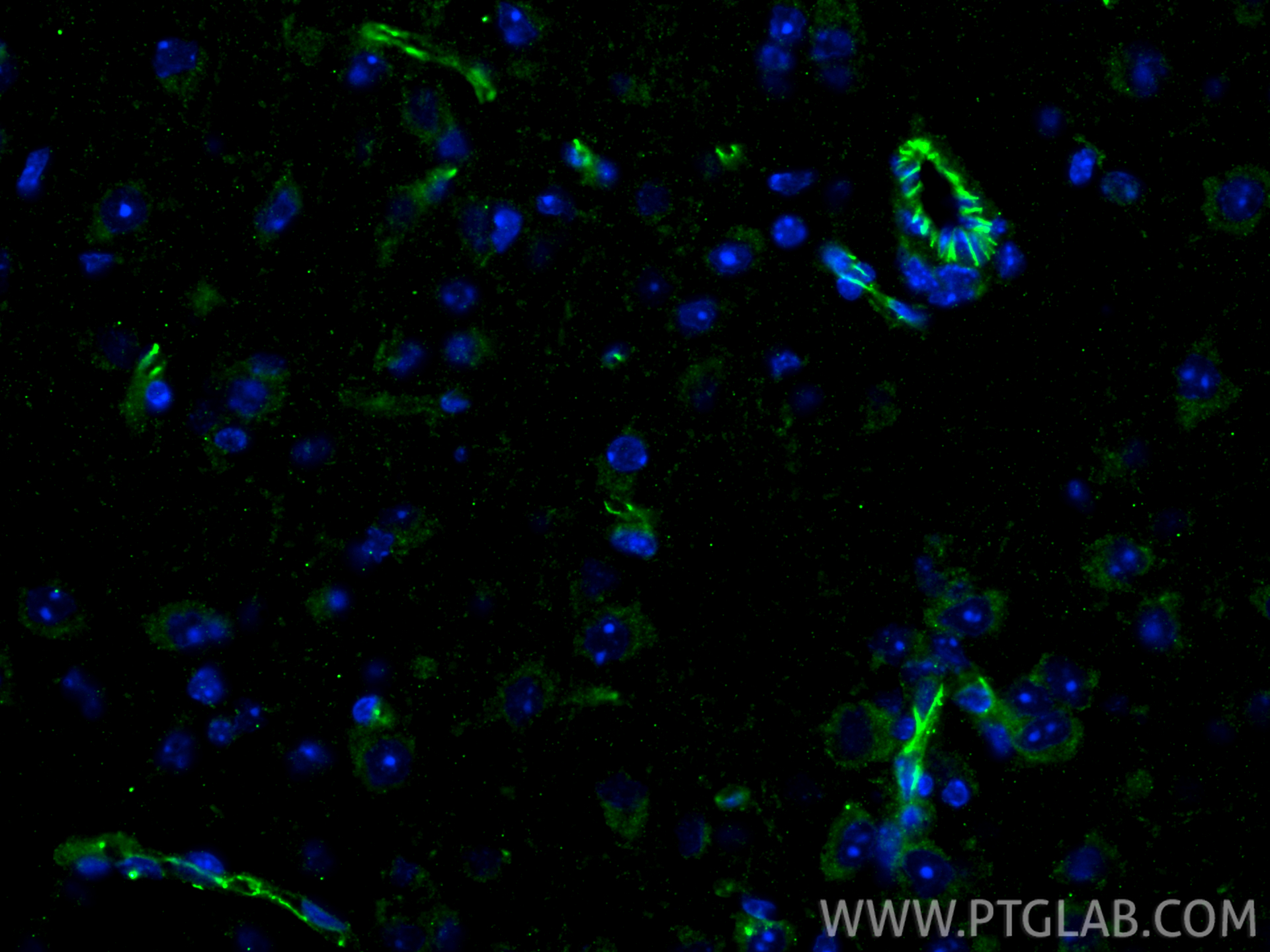 IF Staining of mouse brain using 29767-1-AP IF Staining of mouse brain using 29767-1-AP