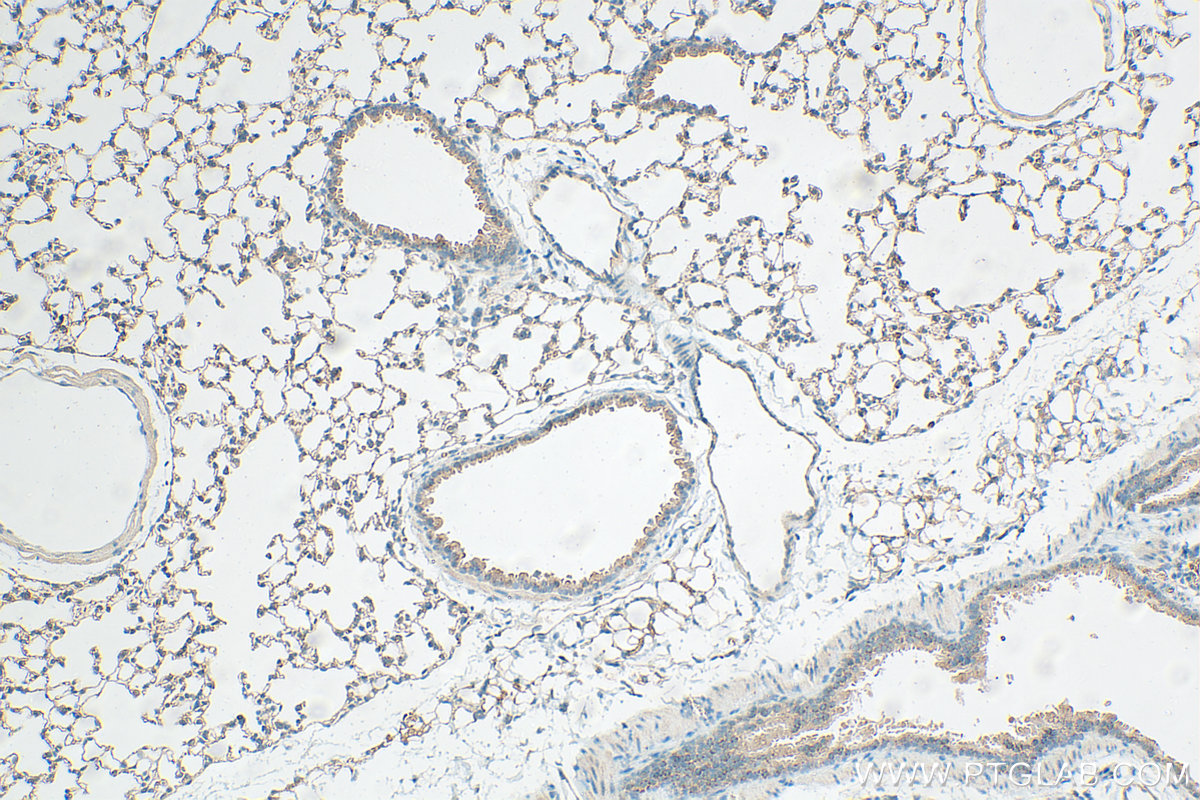 Immunohistochemical analysis of paraffin-embedded mouse lung tissue slide using 29767-1-AP (Claudin 5 antibody) at dilution of 1:800 (under 10x lens). Heat mediated antigen retrieval with Tris-EDTA buffer (pH 9.0). IHC staining of mouse lung using 29767-1-AP