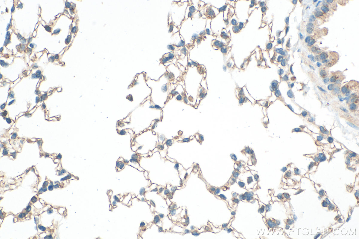 Immunohistochemical analysis of paraffin-embedded mouse lung tissue slide using <a class='green' href='/productredirect?CatalogNo=29767-1-AP' target='_blank'>29767-1-AP</a> (Claudin 5 antibody) at dilution of 1:800 (under 40x lens). Heat mediated antigen retrieval with Tris-EDTA buffer (pH 9.0). This data was developed using the same antibody clone with 29767-1-PBS in a different storage buffer formulation. IHC staining of mouse lung using 29767-1-AP (same clone as 29767-1-PBS)