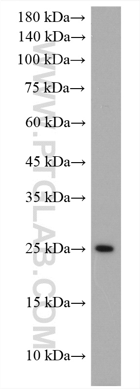 WB analysis of mouse lung using 17738-1-AP