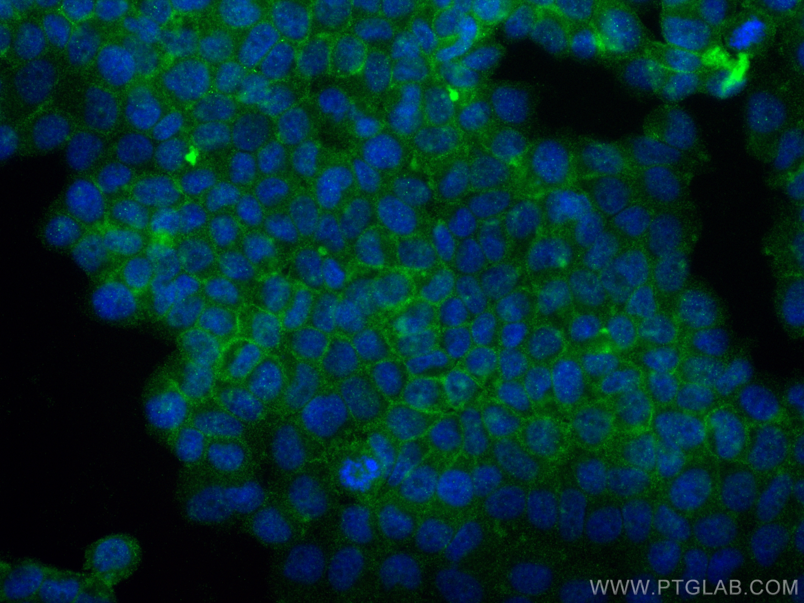 IF Staining of T-47D using 30520-1-AP (same clone as 30520-1-PBS)