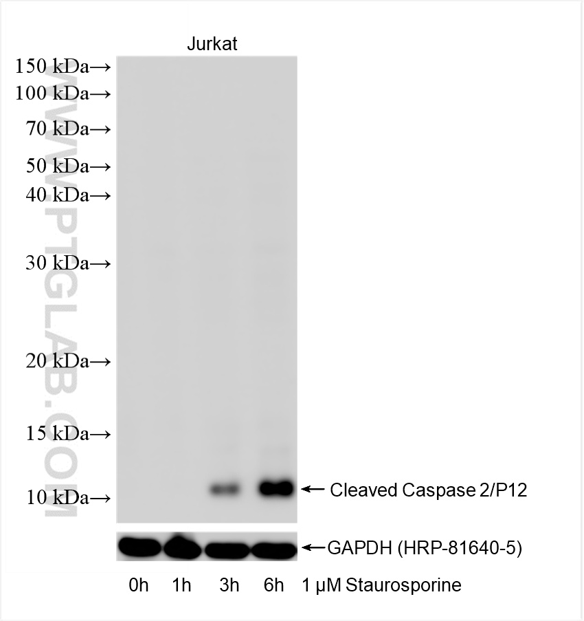 WB analysis of Jurkat using 88209-2-RR (same clone as 88209-2-PBS) WB analysis of Jurkat using 88209-2-RR (same clone as 88209-2-PBS)