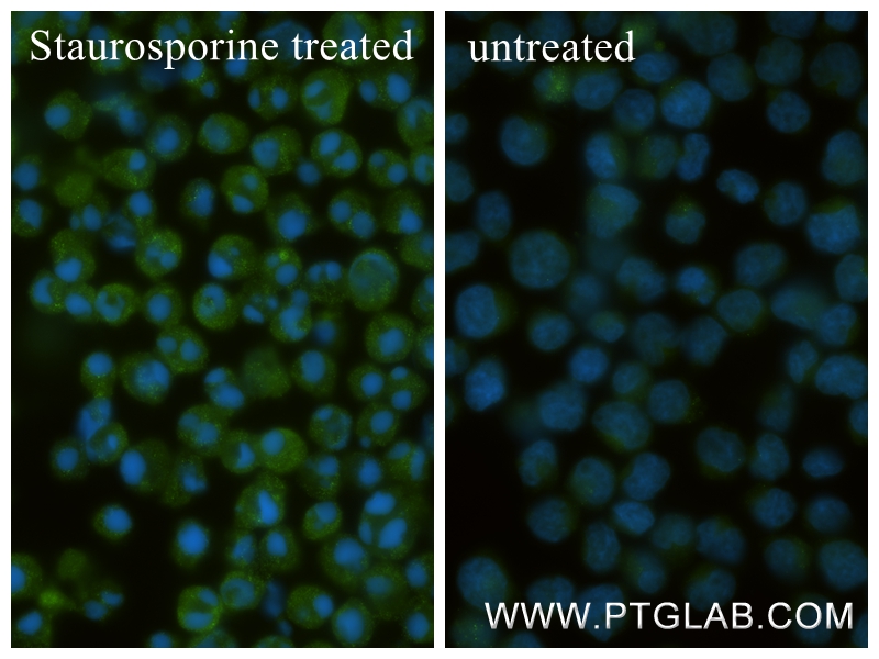 Immunofluorescent analysis of (4% PFA) fixed Staurosporine treated Jurkat cells using Cleaved Caspase 3/P12 antibody (<a class='green' href='/productredirect?CatalogNo=87055-4-RR' target='_blank'>87055-4-RR</a>, Clone: 252012D12 ) at dilution of 1:800 and CoraLite®488-Conjugated Goat Anti-Rabbit IgG(H+L) (<a class='green' href='/productredirect?CatalogNo=SA00013-2' target='_blank'>SA00013-2</a>). This data was developed using the same antibody clone with 87055-4-PBS in a different storage buffer formulation. IF Staining of Jurkat using 87055-4-RR (same clone as 87055-4-PBS)