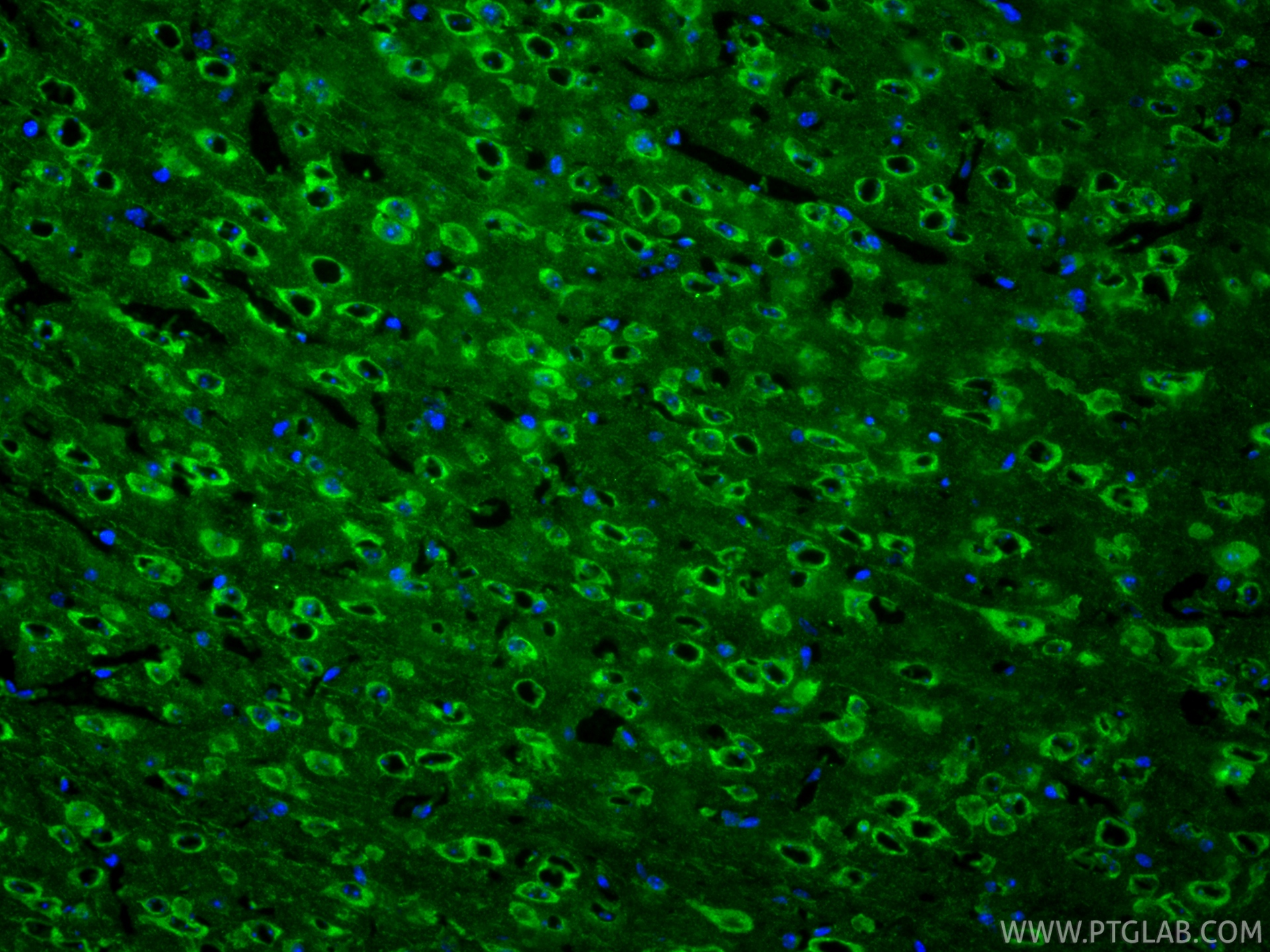IF Staining of mouse brain using 68773-1-Ig IF Staining of mouse brain using 68773-1-Ig