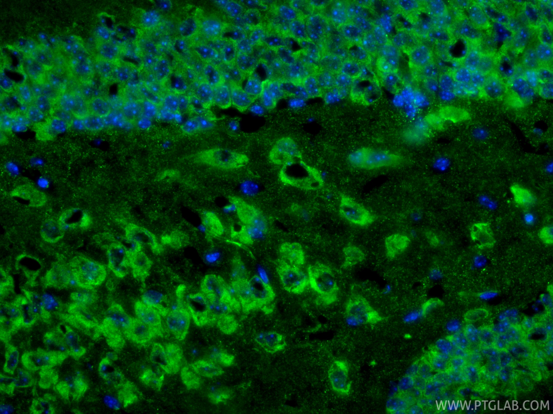 IF Staining of mouse brain using 68773-1-Ig IF Staining of mouse brain using 68773-1-Ig
