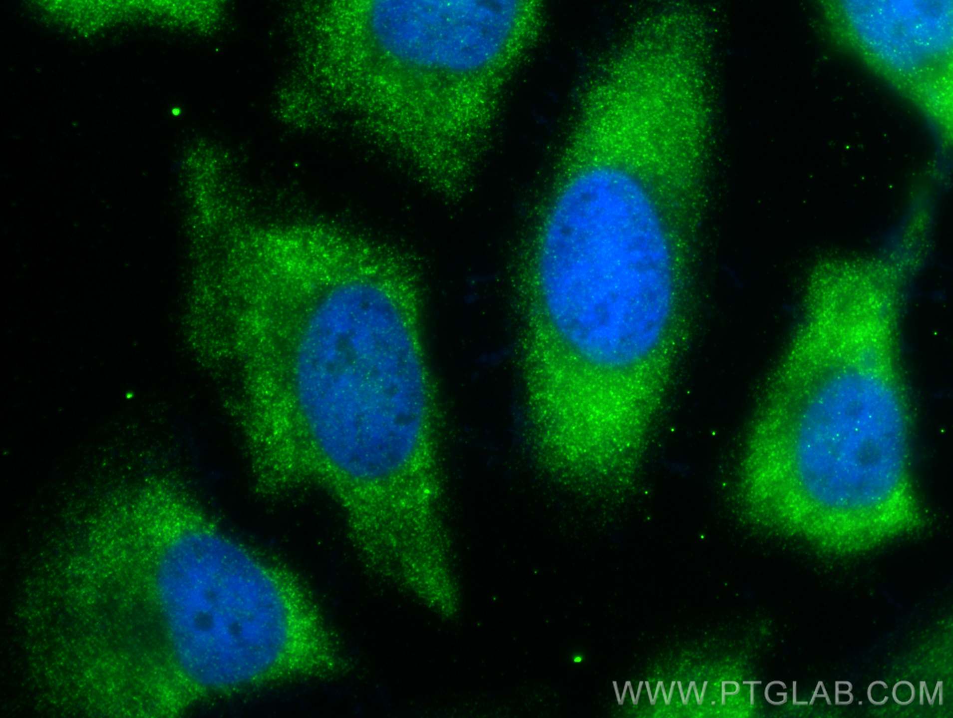 IF Staining of HeLa using RMX00003