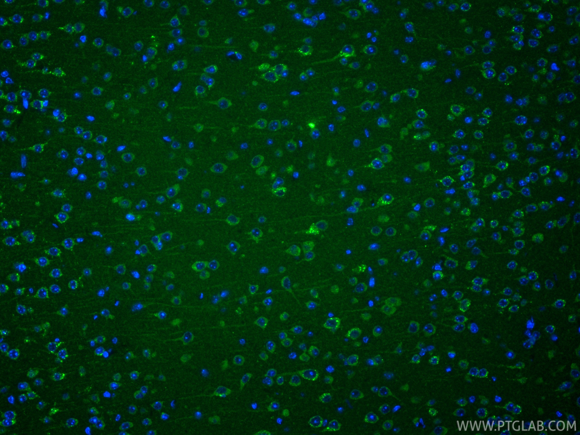 IF Staining of mouse brain using RMX00003 IF Staining of mouse brain using RMX00003