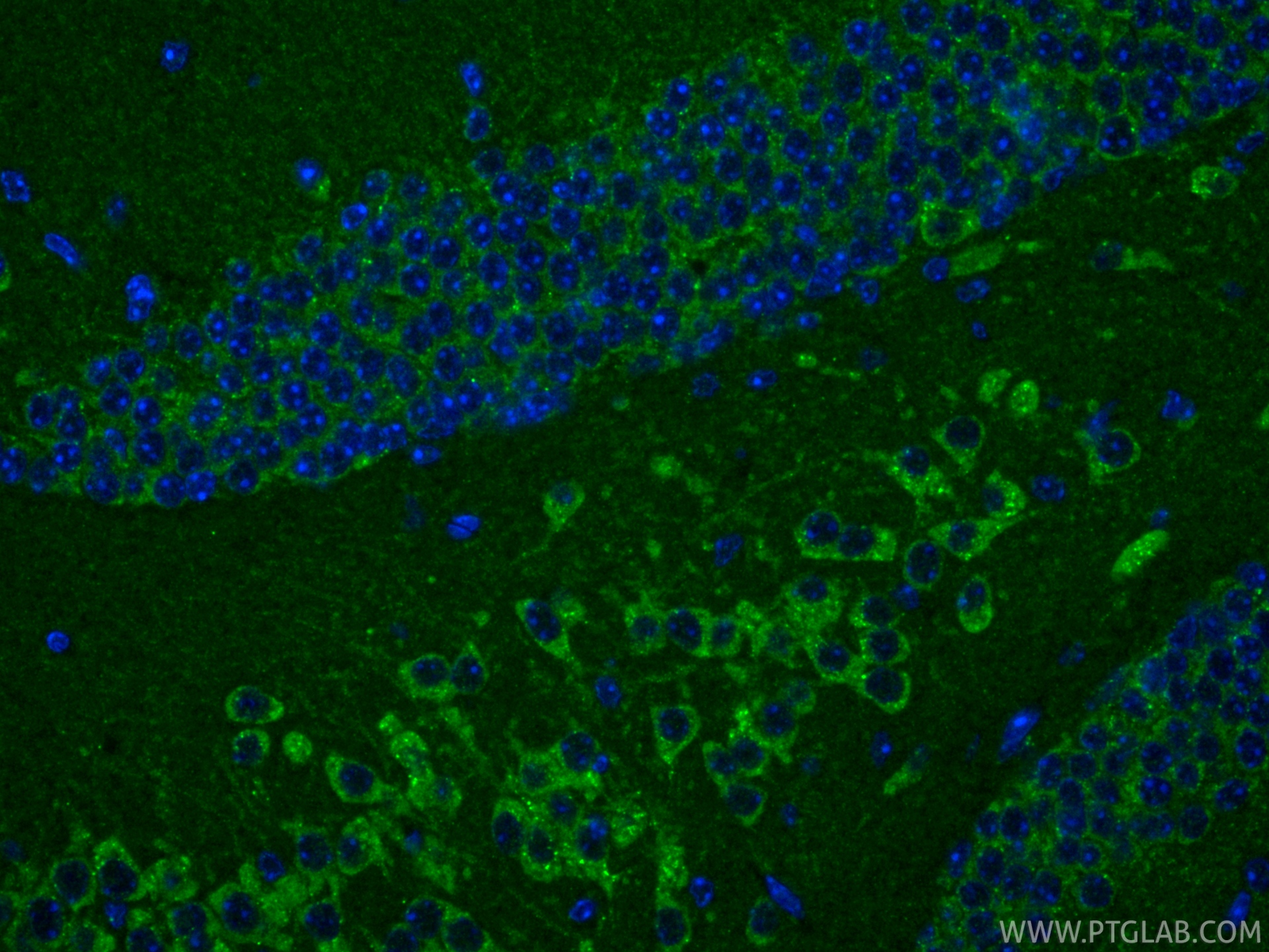 IF Staining of mouse brain using RMX00003 IF Staining of mouse brain using RMX00003