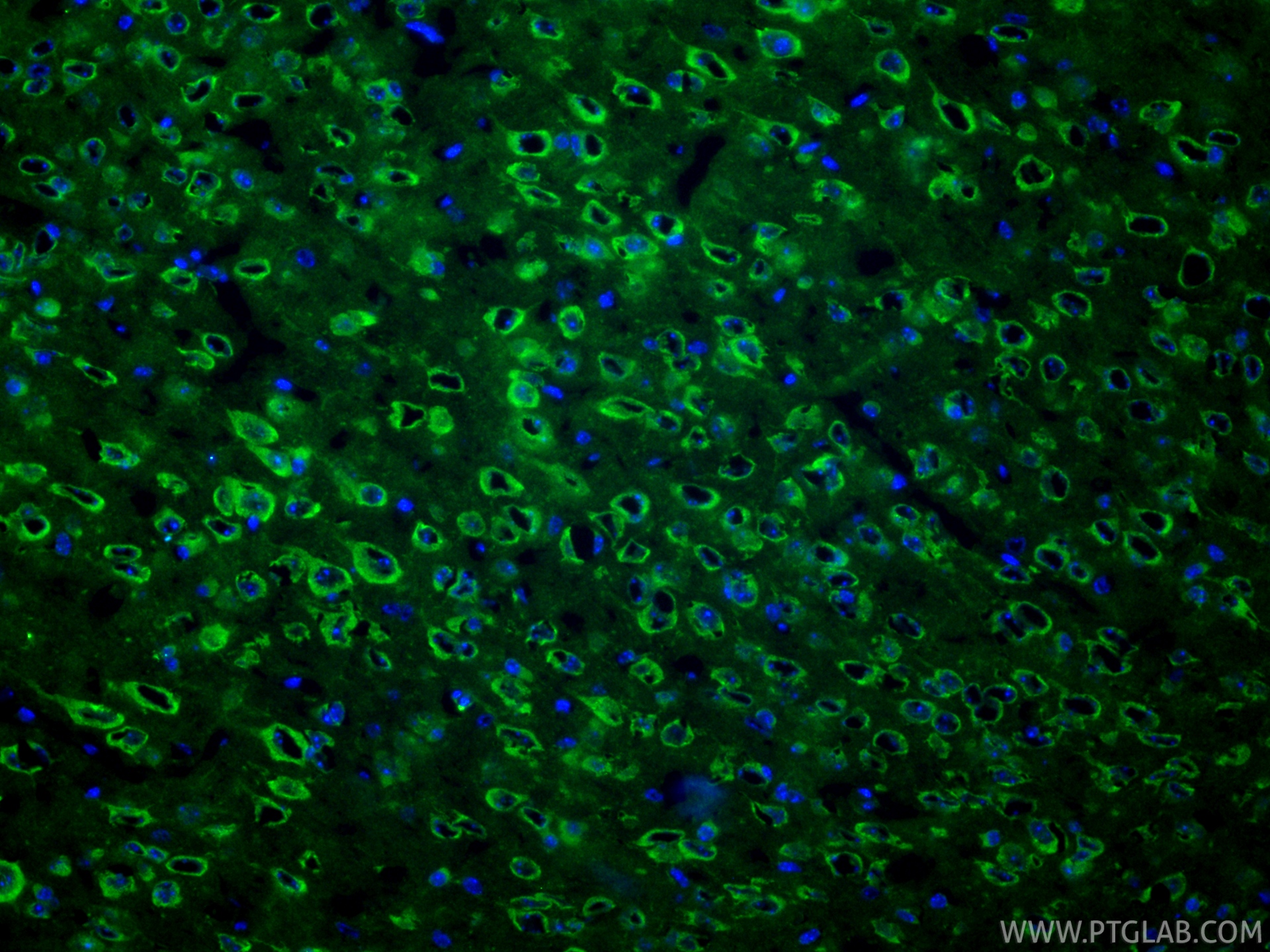 IF Staining of mouse brain using RMX00003 IF Staining of mouse brain using RMX00003
