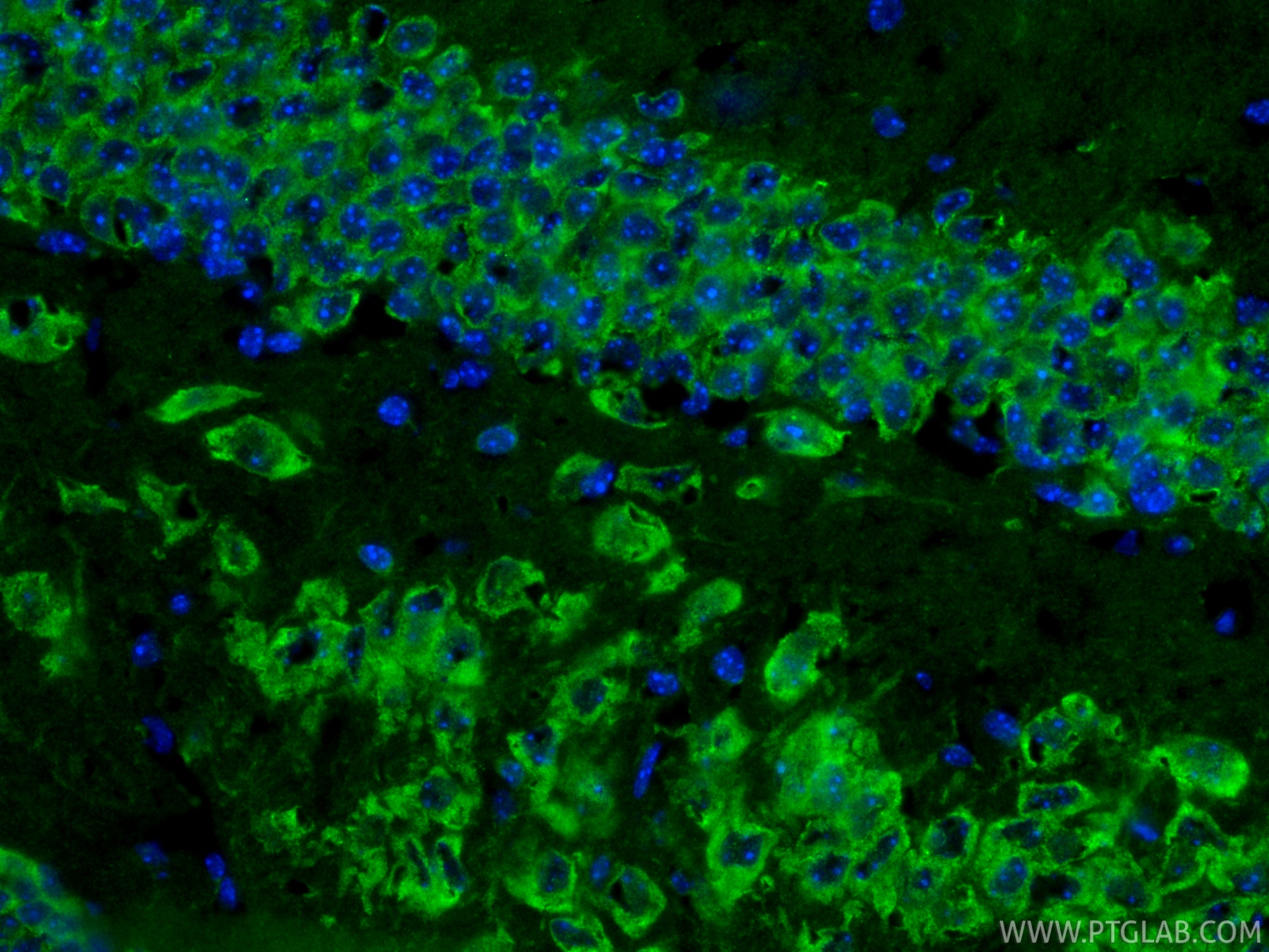 IF Staining of mouse brain using RMX00003 IF Staining of mouse brain using RMX00003