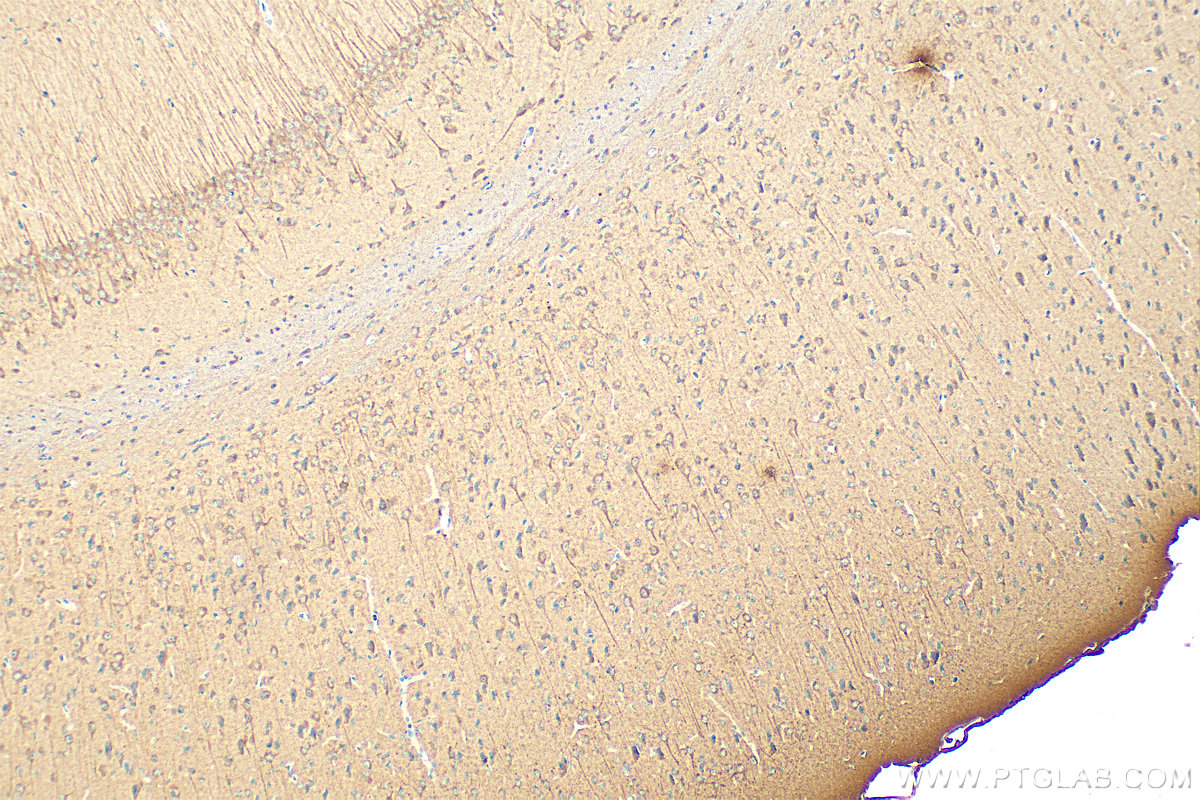 IHC staining of mouse brain using RMX00003