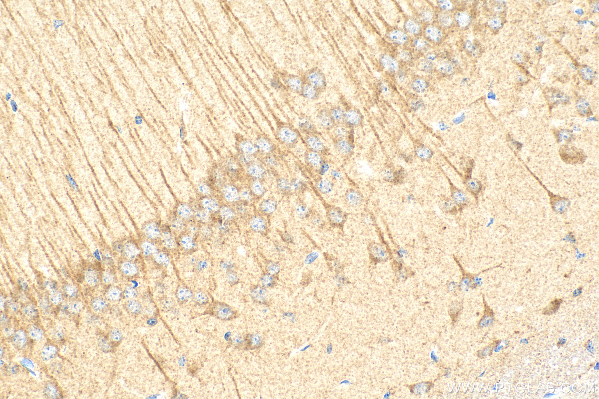 IHC staining of mouse brain using RMX00003
