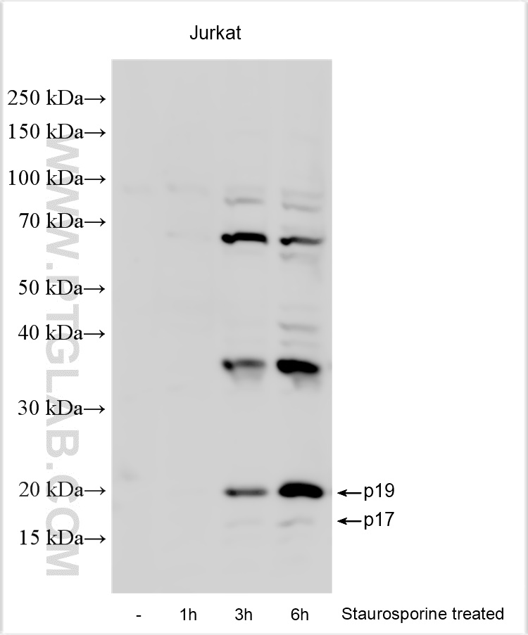 WB analysis of Jurkat using RMX00003