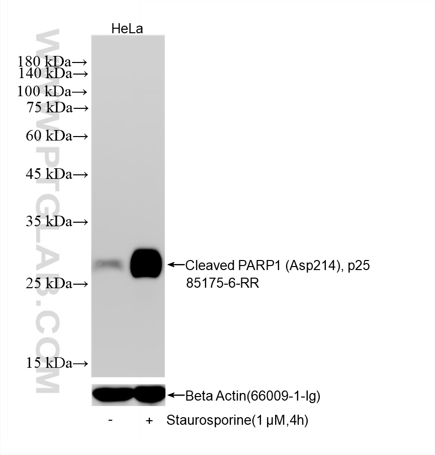 WB analysis using 85175-6-RR WB analysis using 85175-6-RR