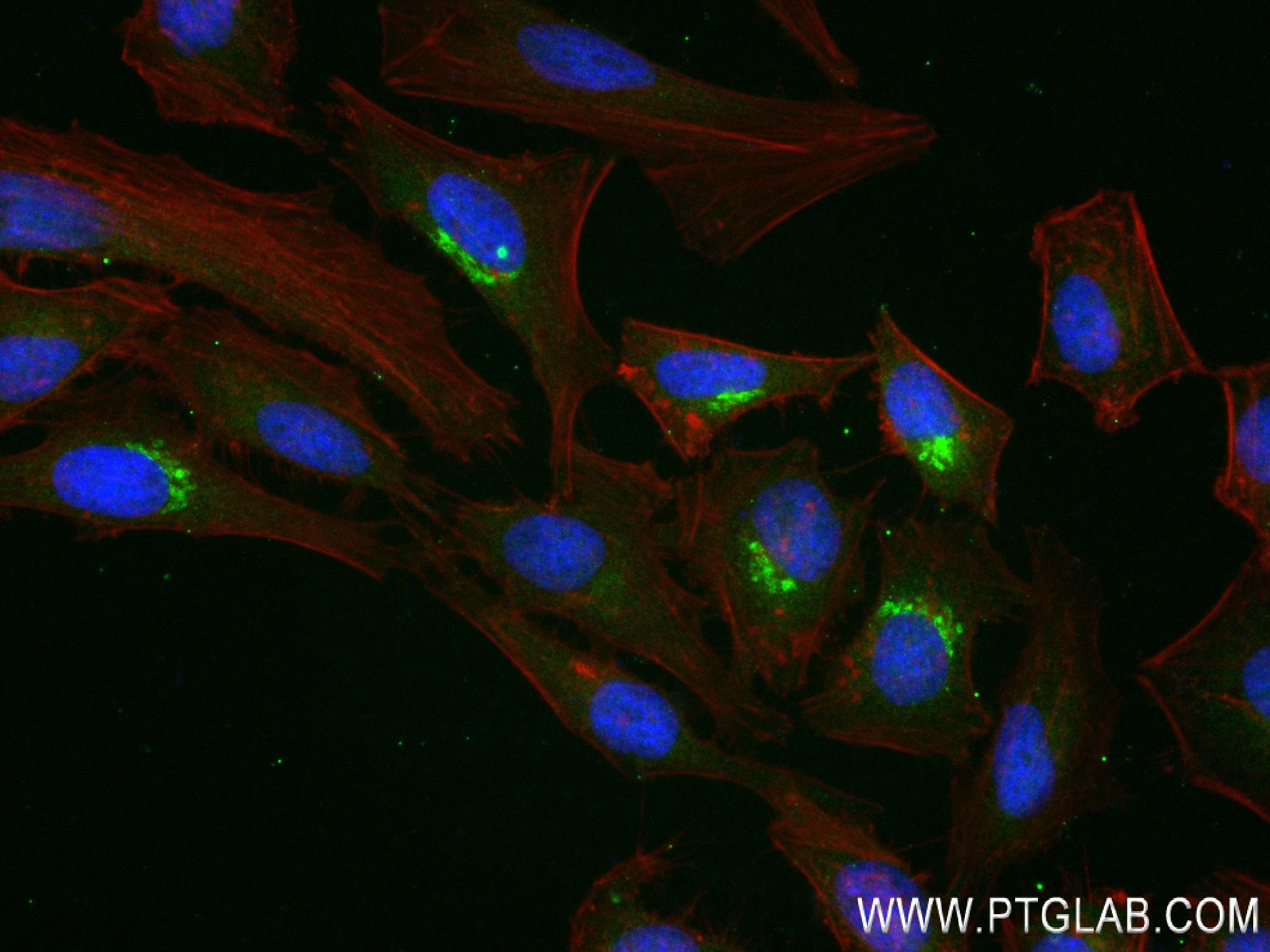 IF Staining of HeLa using 84067-5-RR
