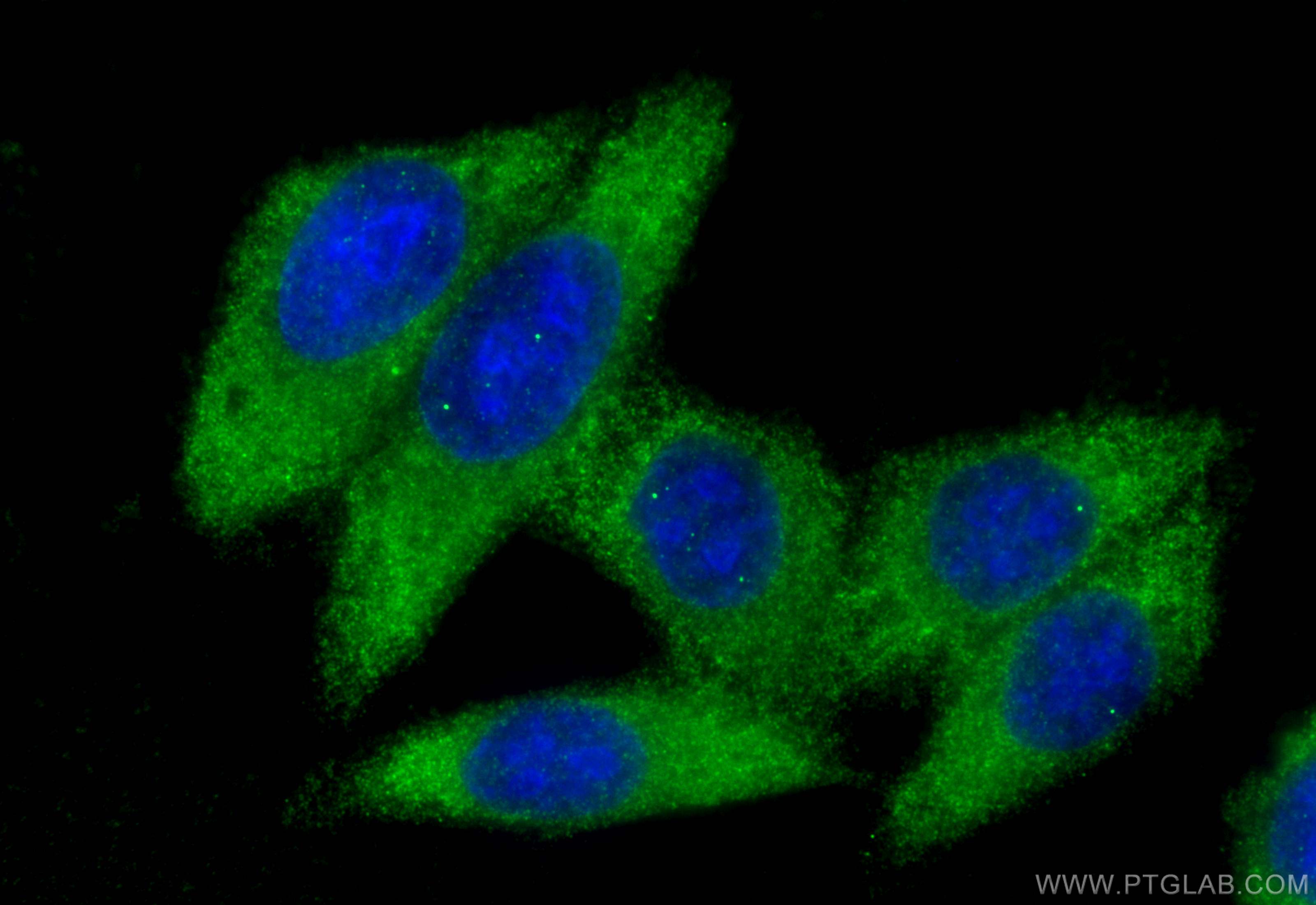 IF Staining of HepG2 using 31615-1-AP