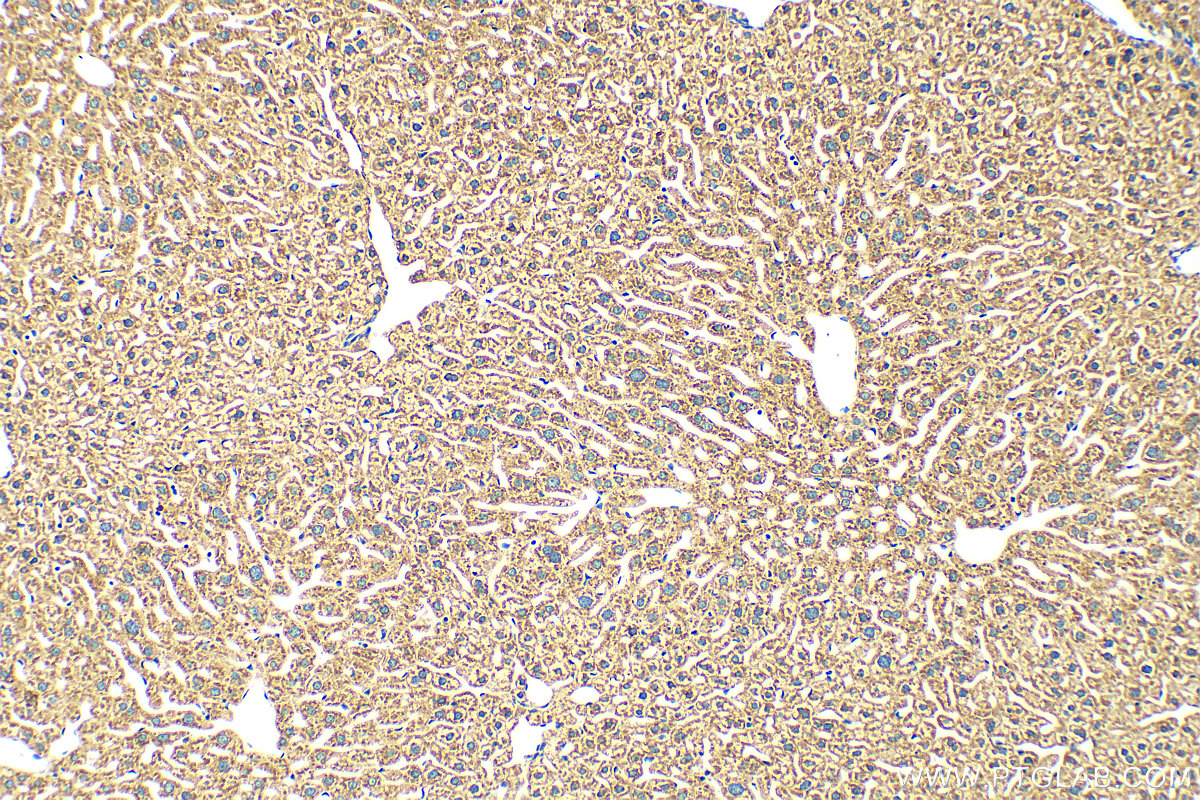 IHC staining of mouse liver using 31615-1-AP
