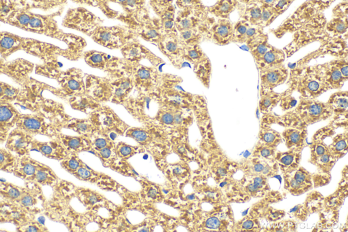 IHC staining of mouse liver using 31615-1-AP