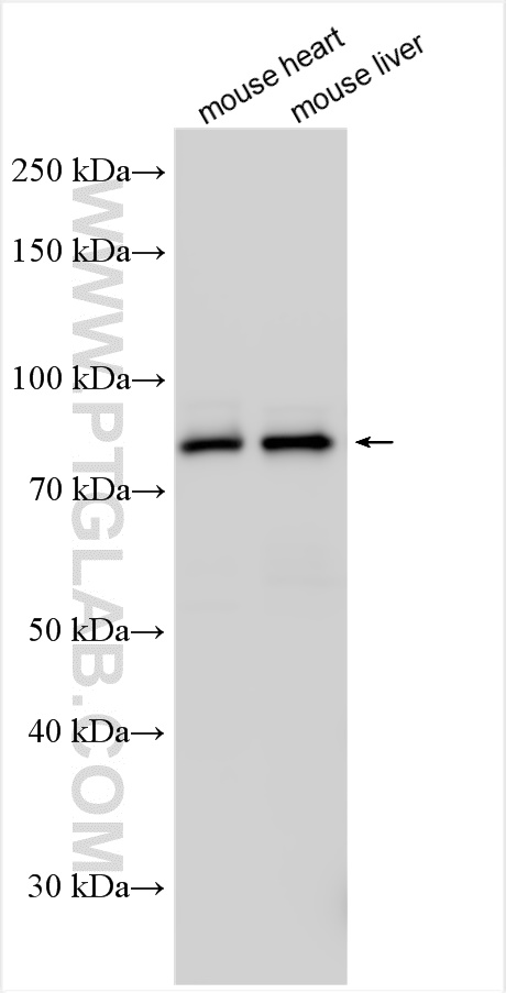 WB analysis using 31615-1-AP