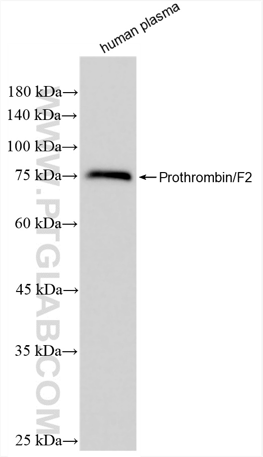 WB analysis of human plasma using 86124-1-RR (same clone as 86124-1-PBS)