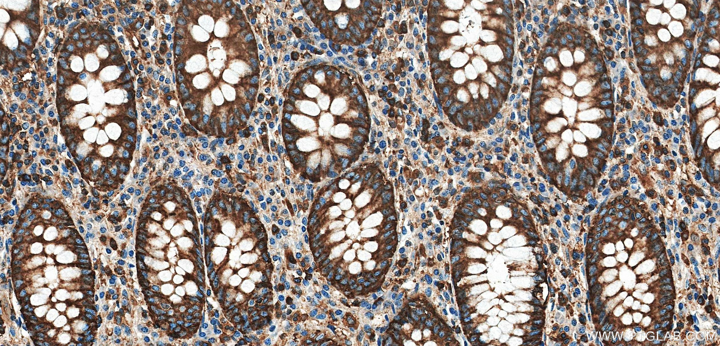 IHC staining of human appendix using 88053-1-RR (same clone as 88053-1-PBS) IHC staining of human appendix using 88053-1-RR (same clone as 88053-1-PBS)