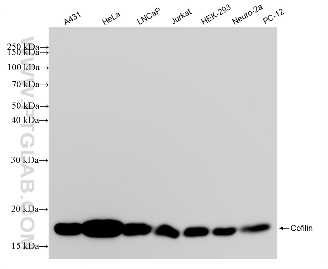 WB analysis using 88053-1-RR (same clone as 88053-1-PBS) WB analysis using 88053-1-RR (same clone as 88053-1-PBS)