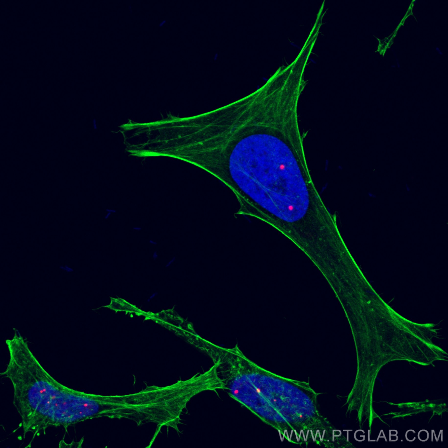 IF Staining of HeLa using CL594-10967