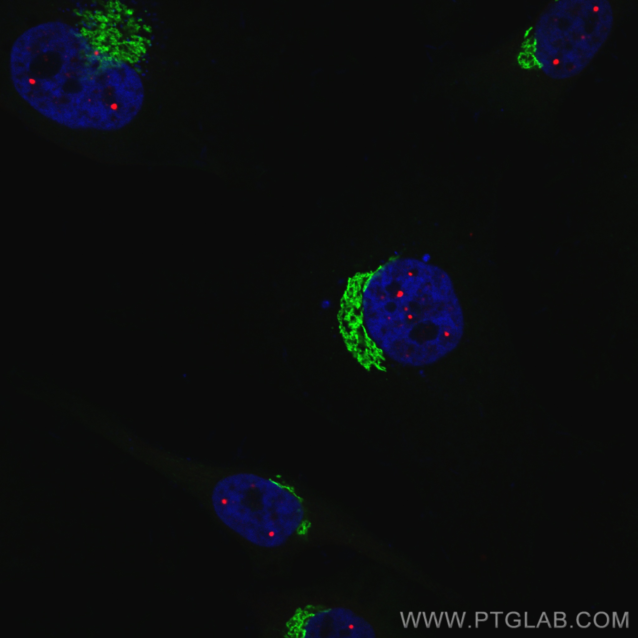 IF Staining of HeLa using CL594-10967