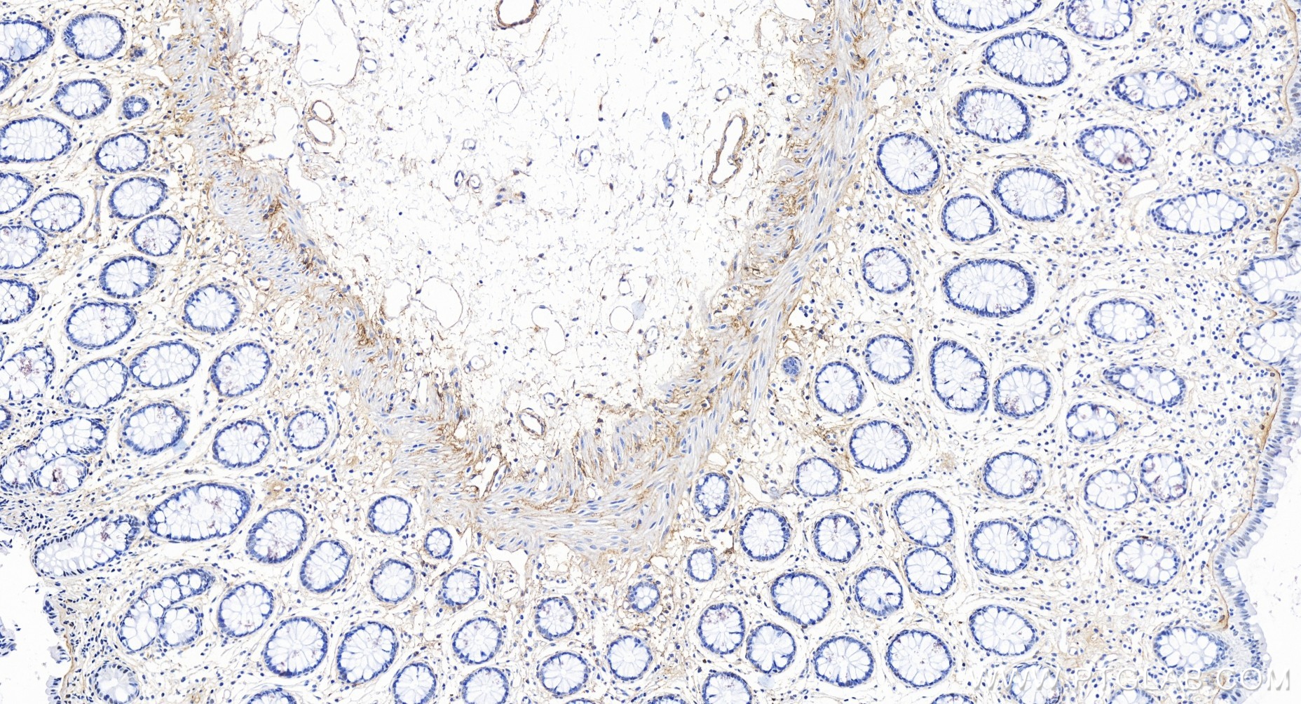 IHC staining of human colon using 86093-1-RR