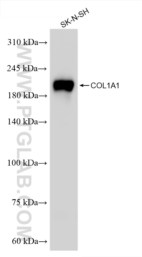 WB analysis of SK-N-SH using 86093-1-RR