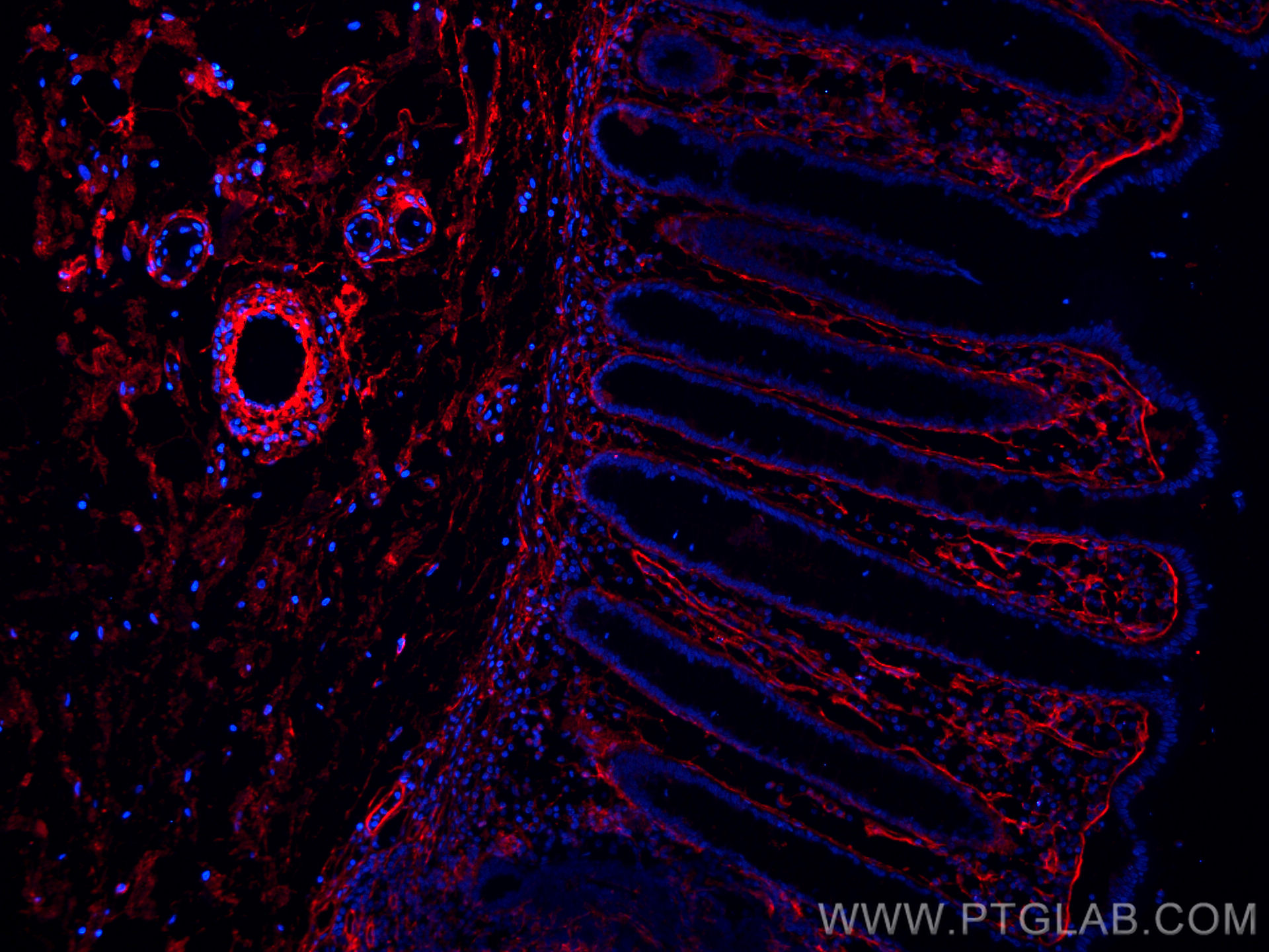 Collagen Type I