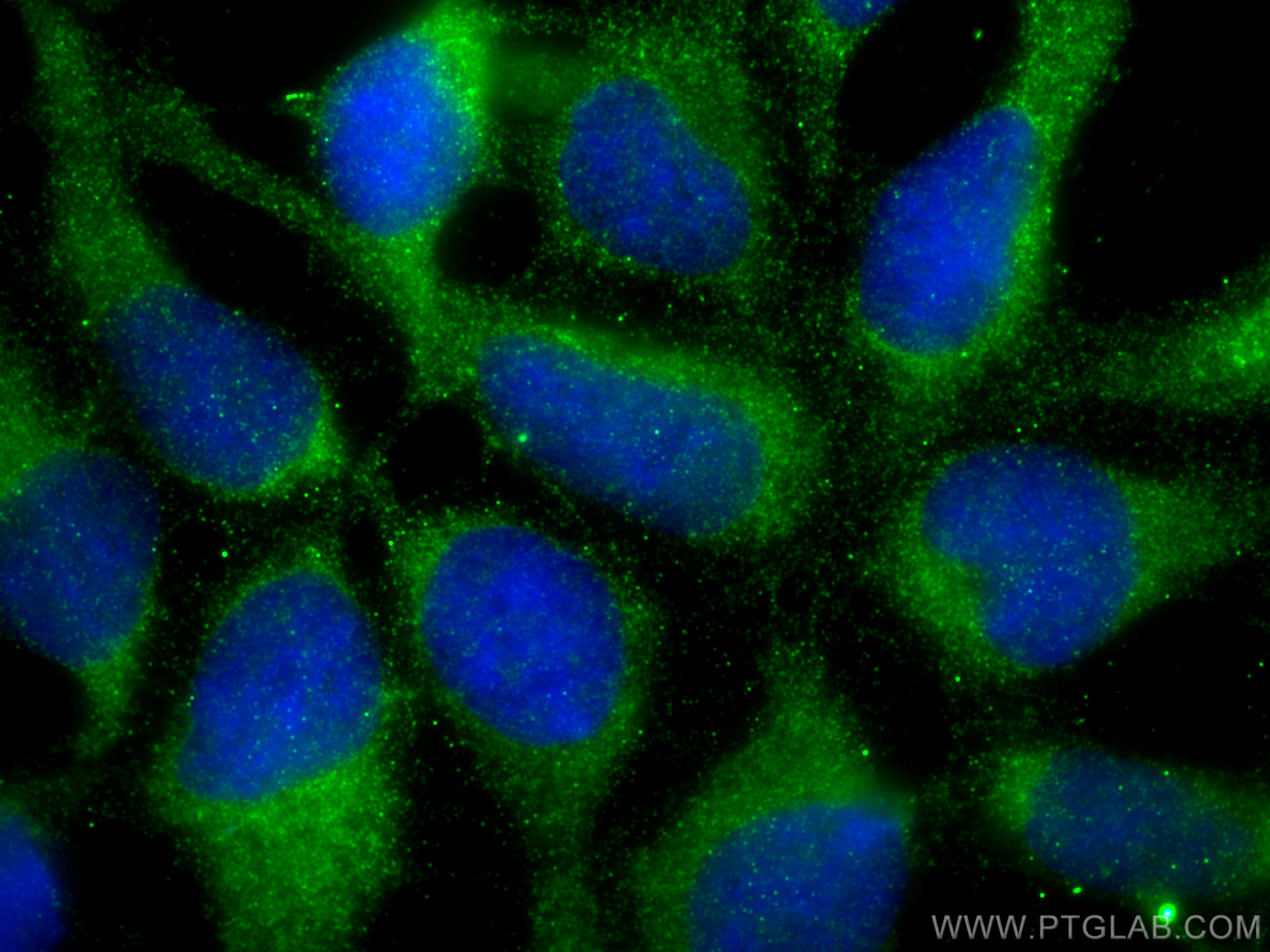 Collagen Type II