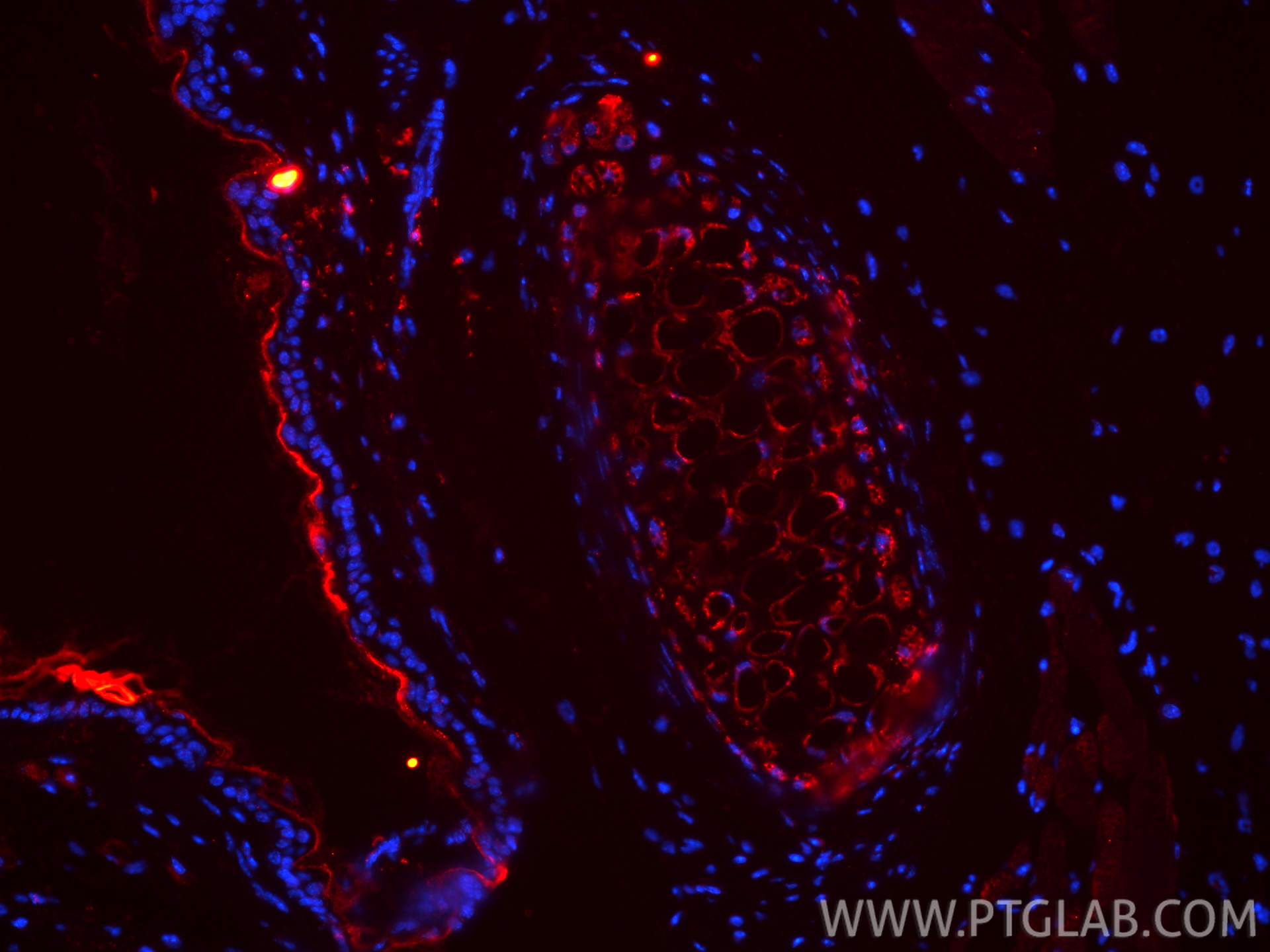 IF Staining of mouse skin using 28459-1-AP IF Staining of mouse skin using 28459-1-AP