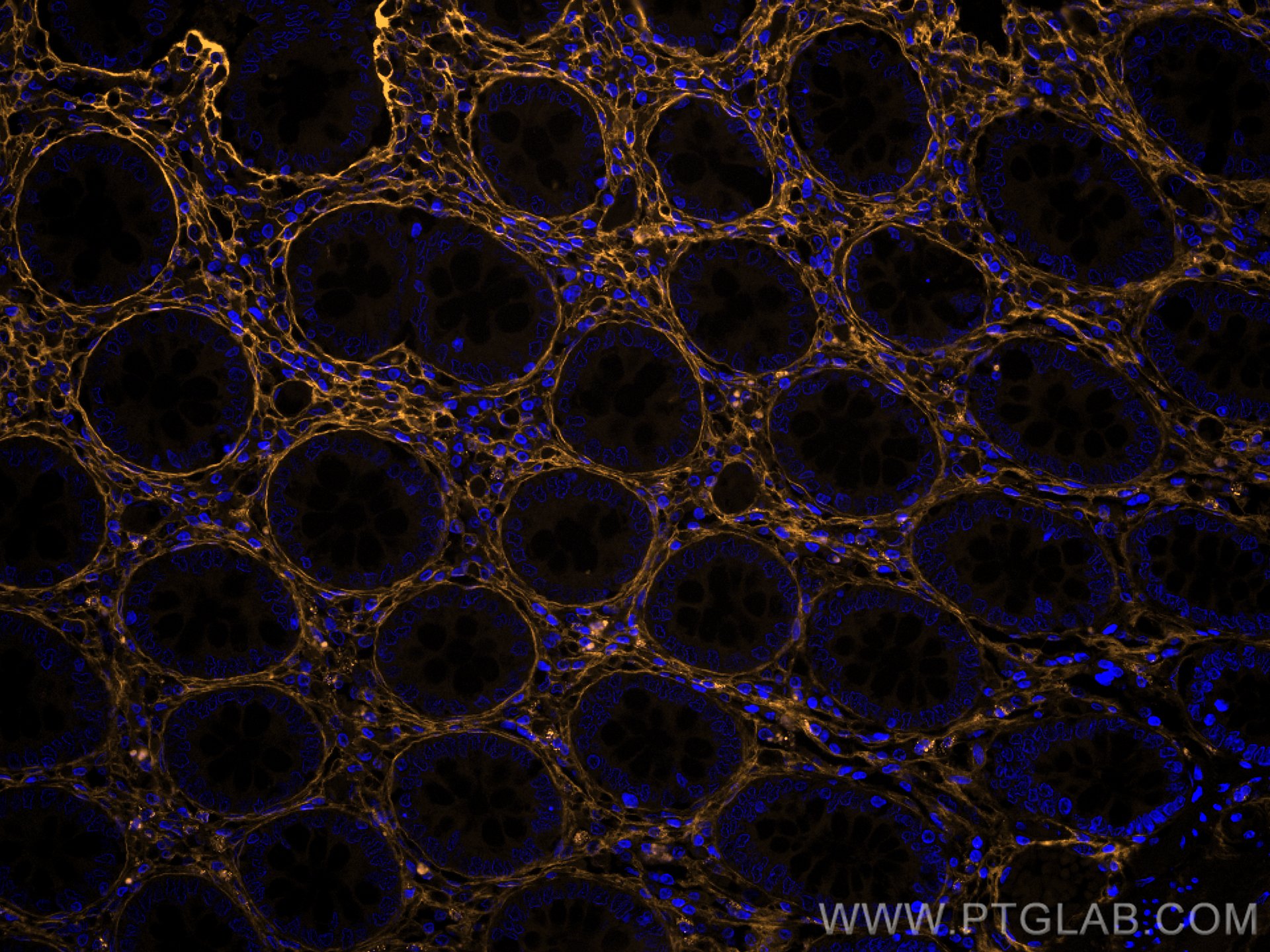 IF Staining of human colon using CL555-80009