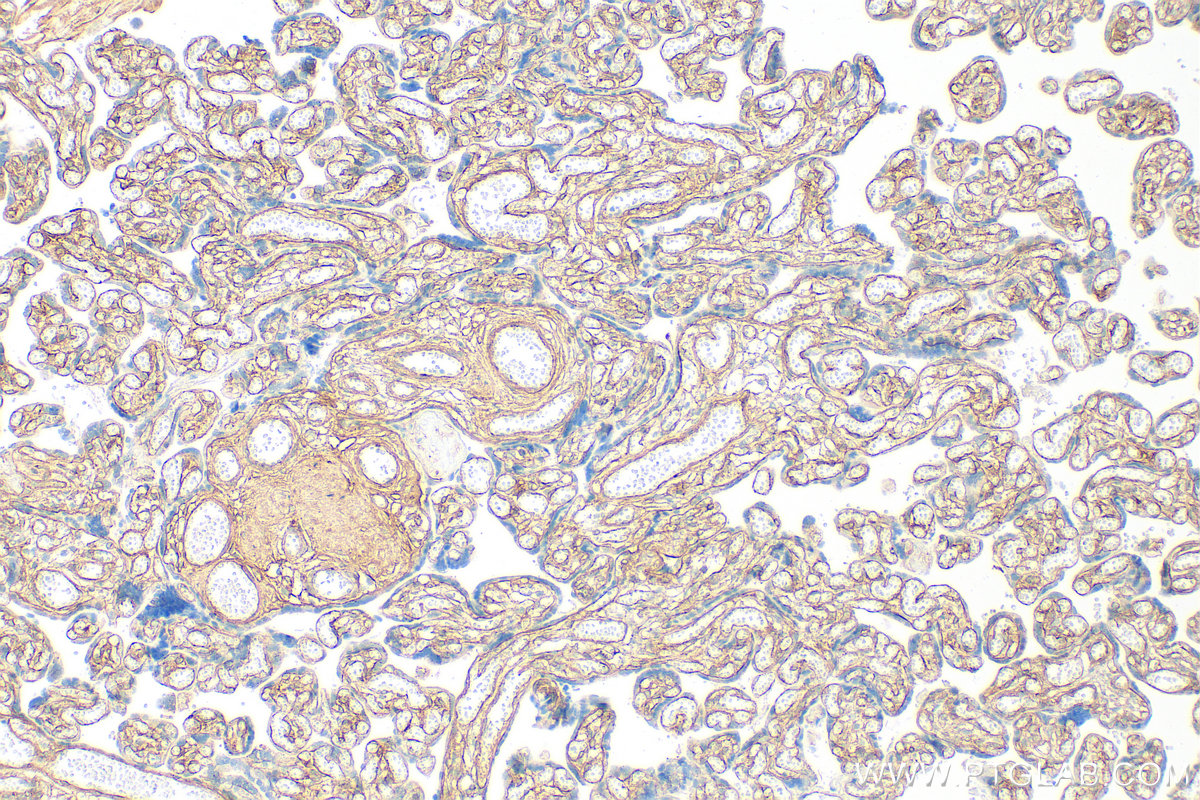 IHC staining of human placenta using 30850-1-AP