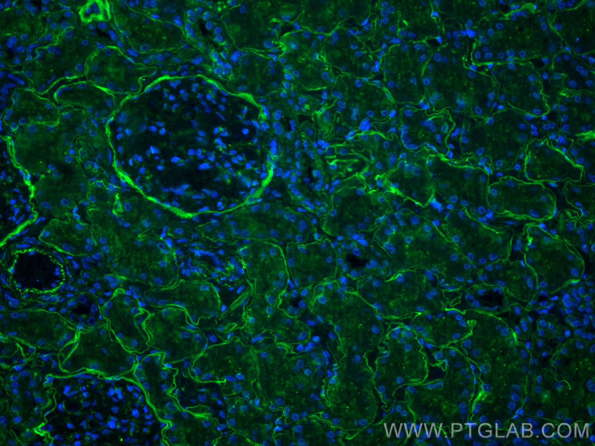 IF Staining of human kidney using 55131-1-AP